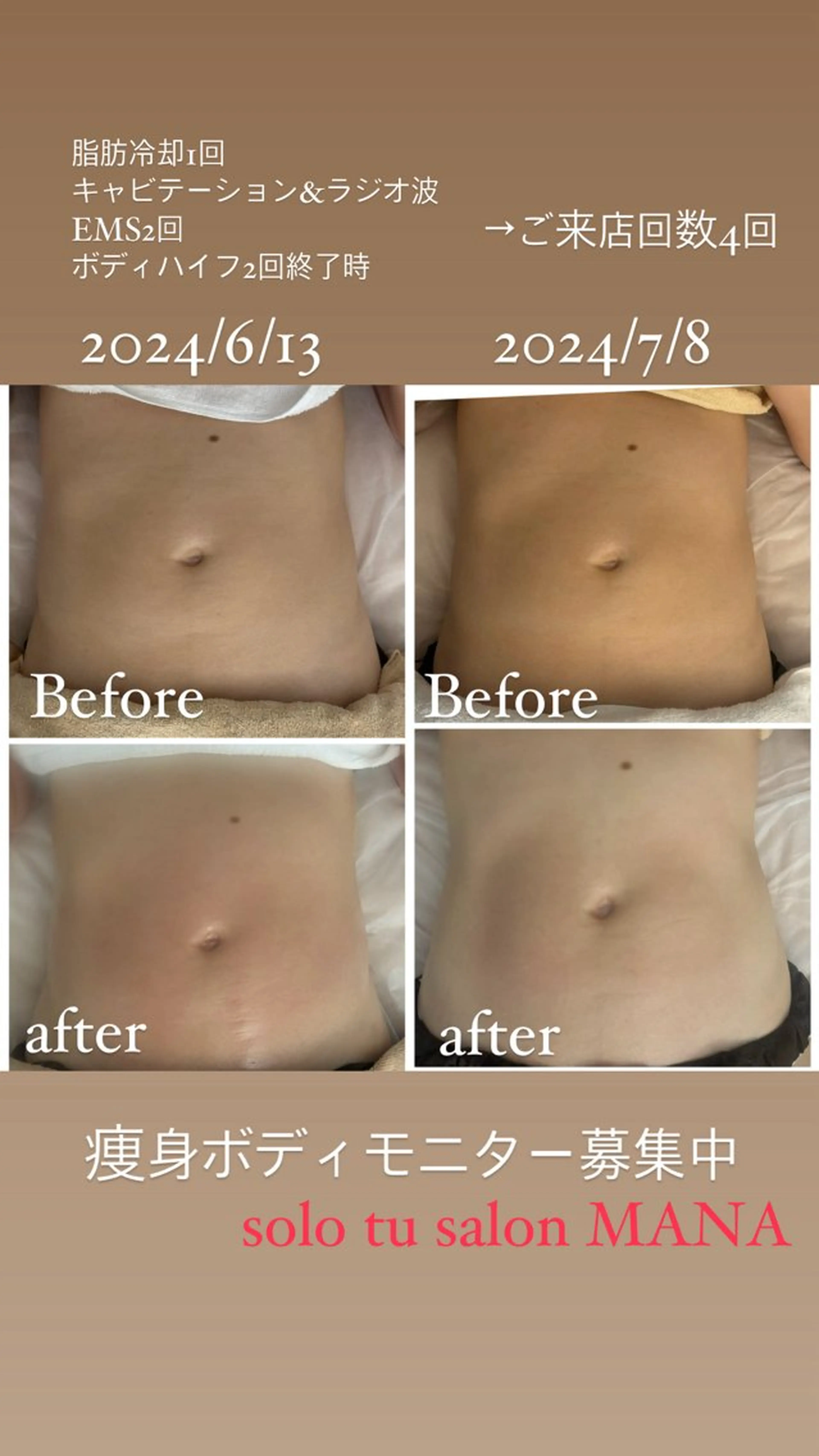 solo tu  salon MANA所属・美肌＆痩身＆脱毛 MANAのエステ・リラクイメージ