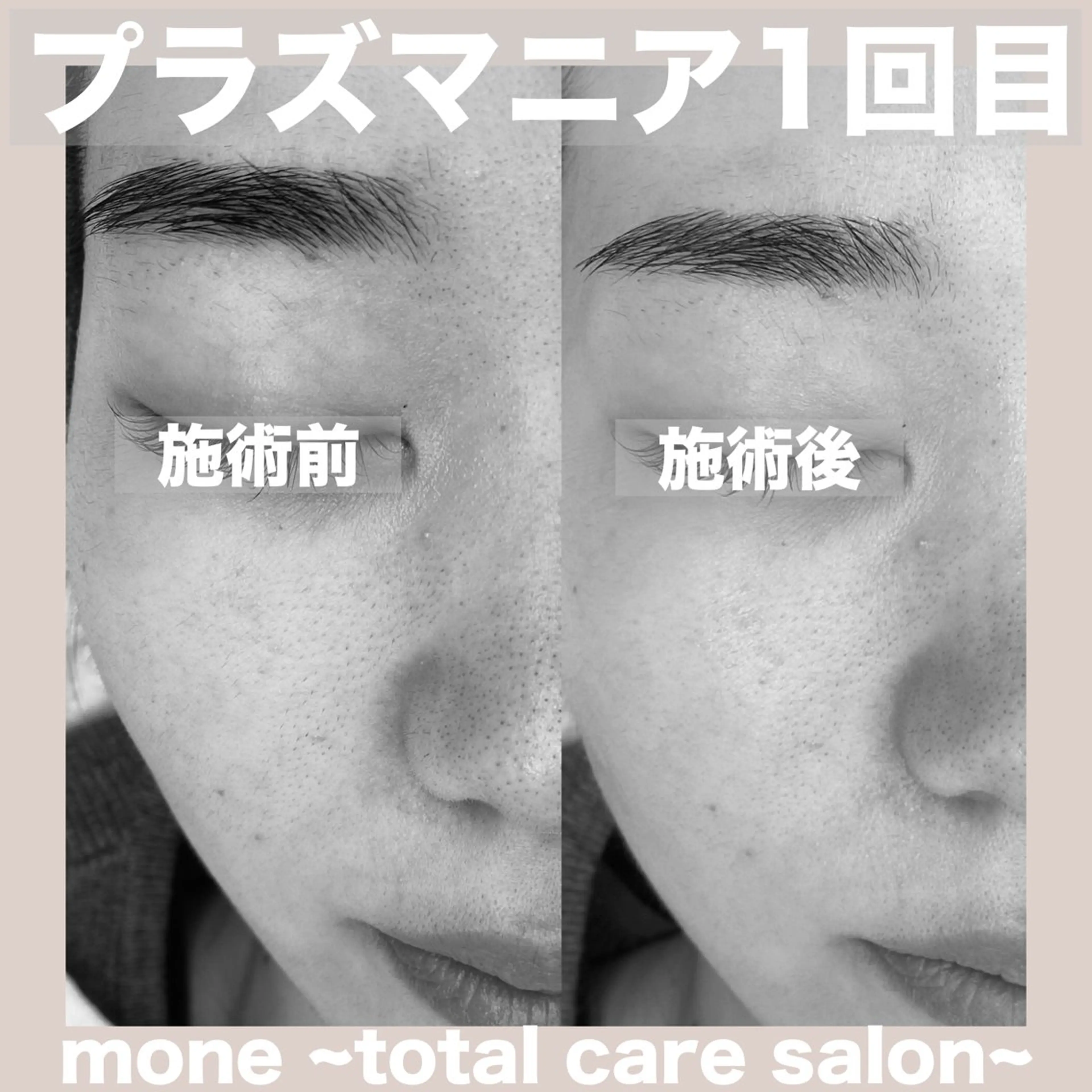 エステ mone~total care salon~所属・mone (モーネ)のマツエク・マツパデザイン
