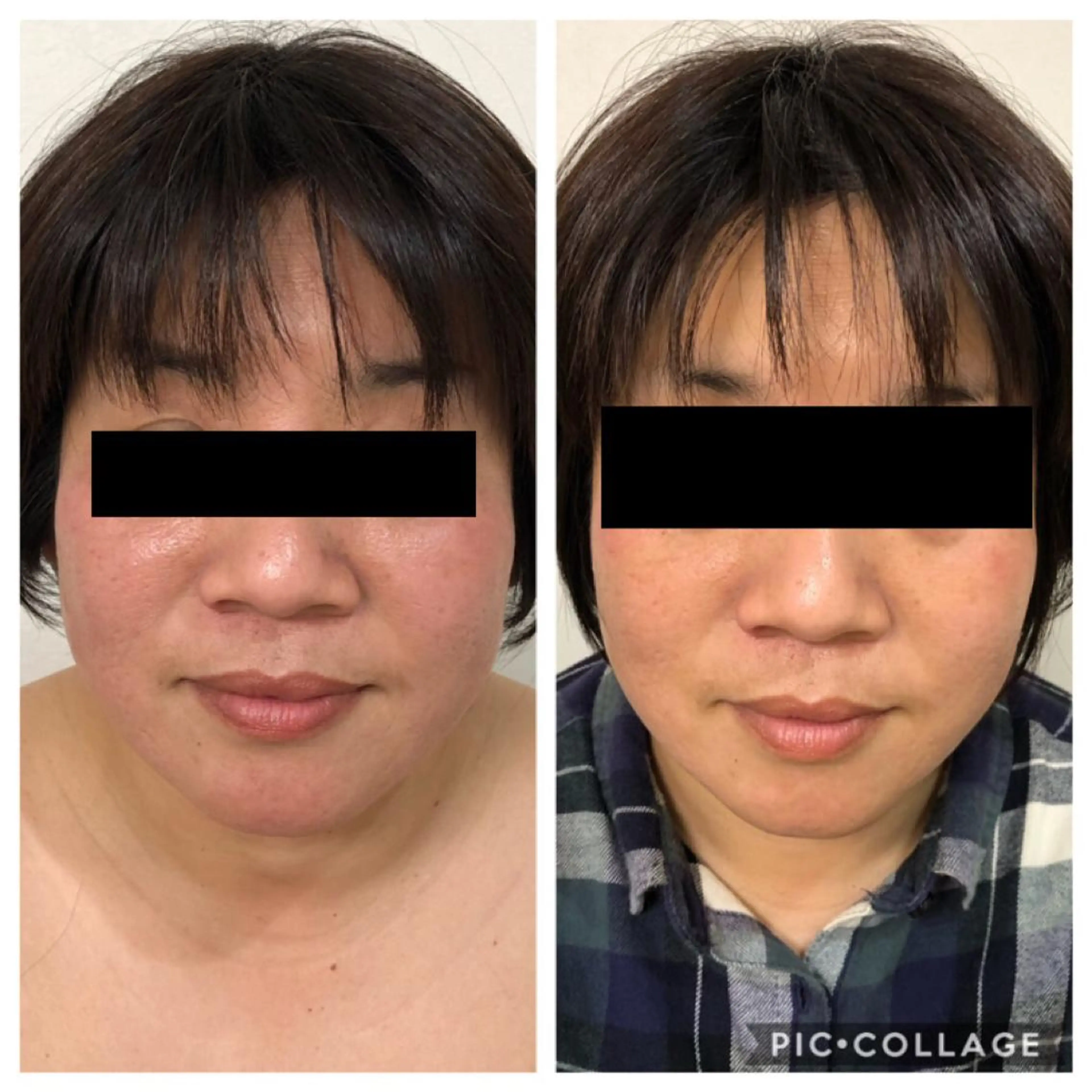 エステ BeautySalonGemmy所属・Gemmy 愛美のエステ・リラクイメージ