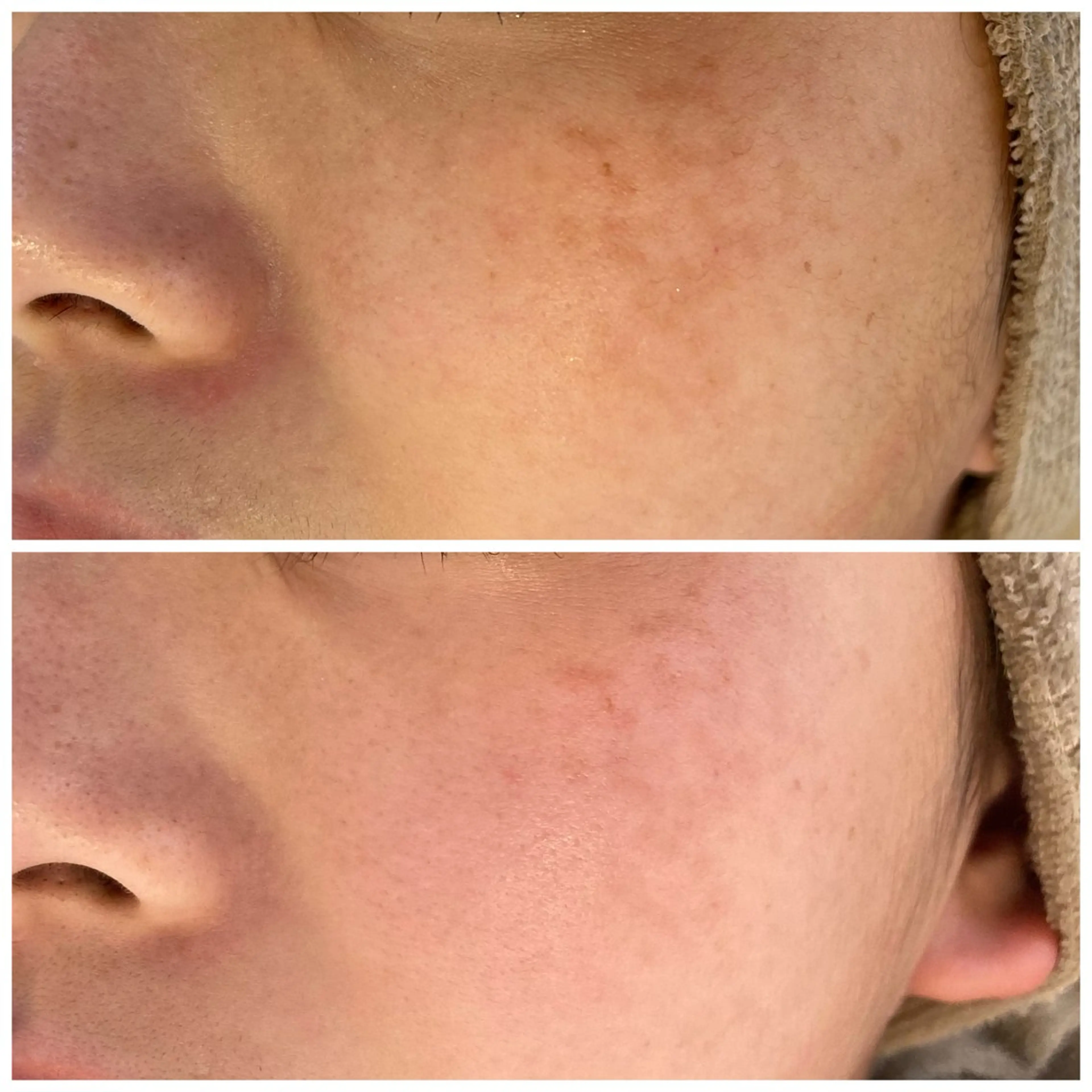 エステ Lassy keikoのその他イメージ