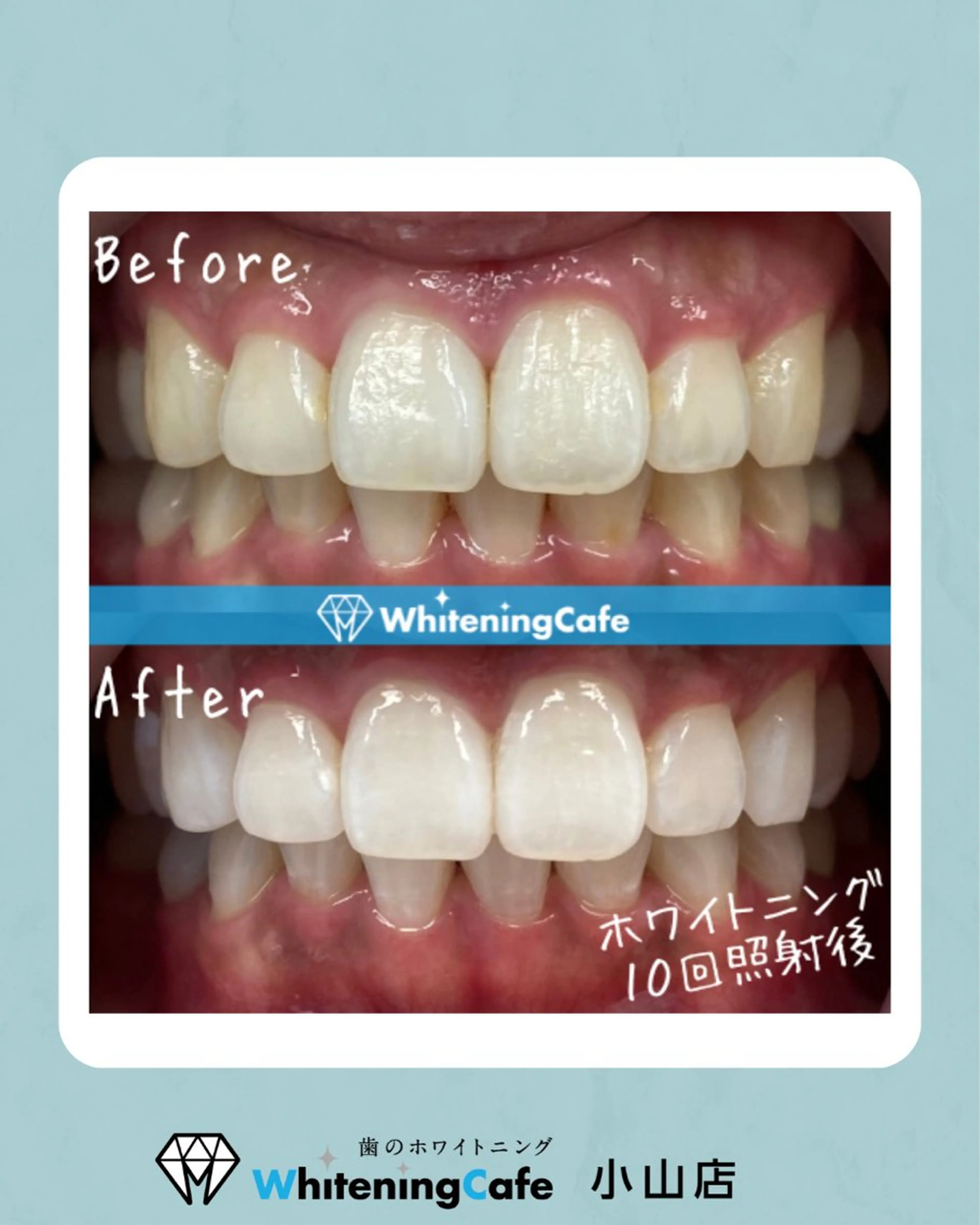 ホワイトニングカフェ 小山店のエステ・リラクイメージ