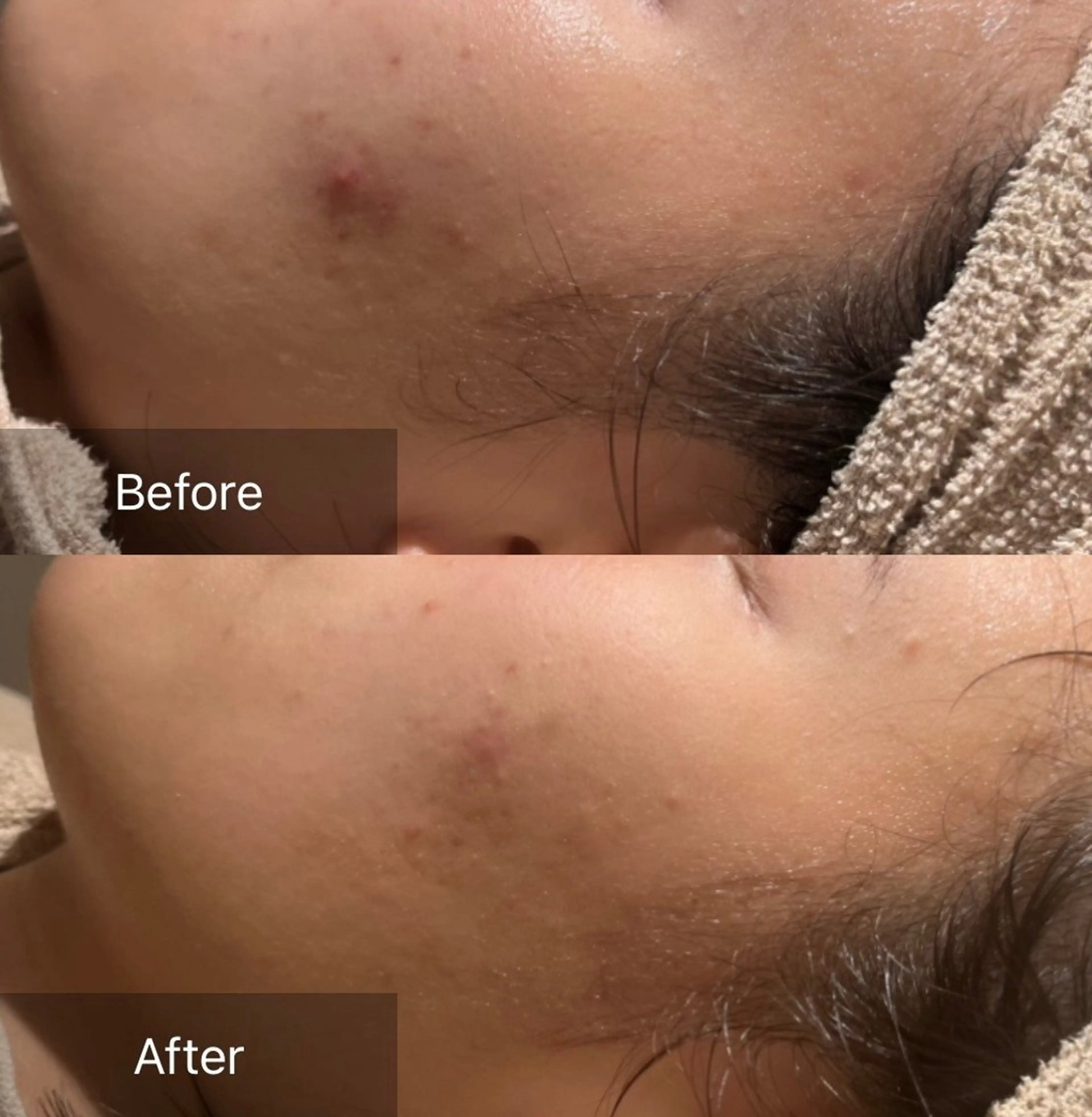 その他 for woman所属・森 美優のエステ・リラクイメージ