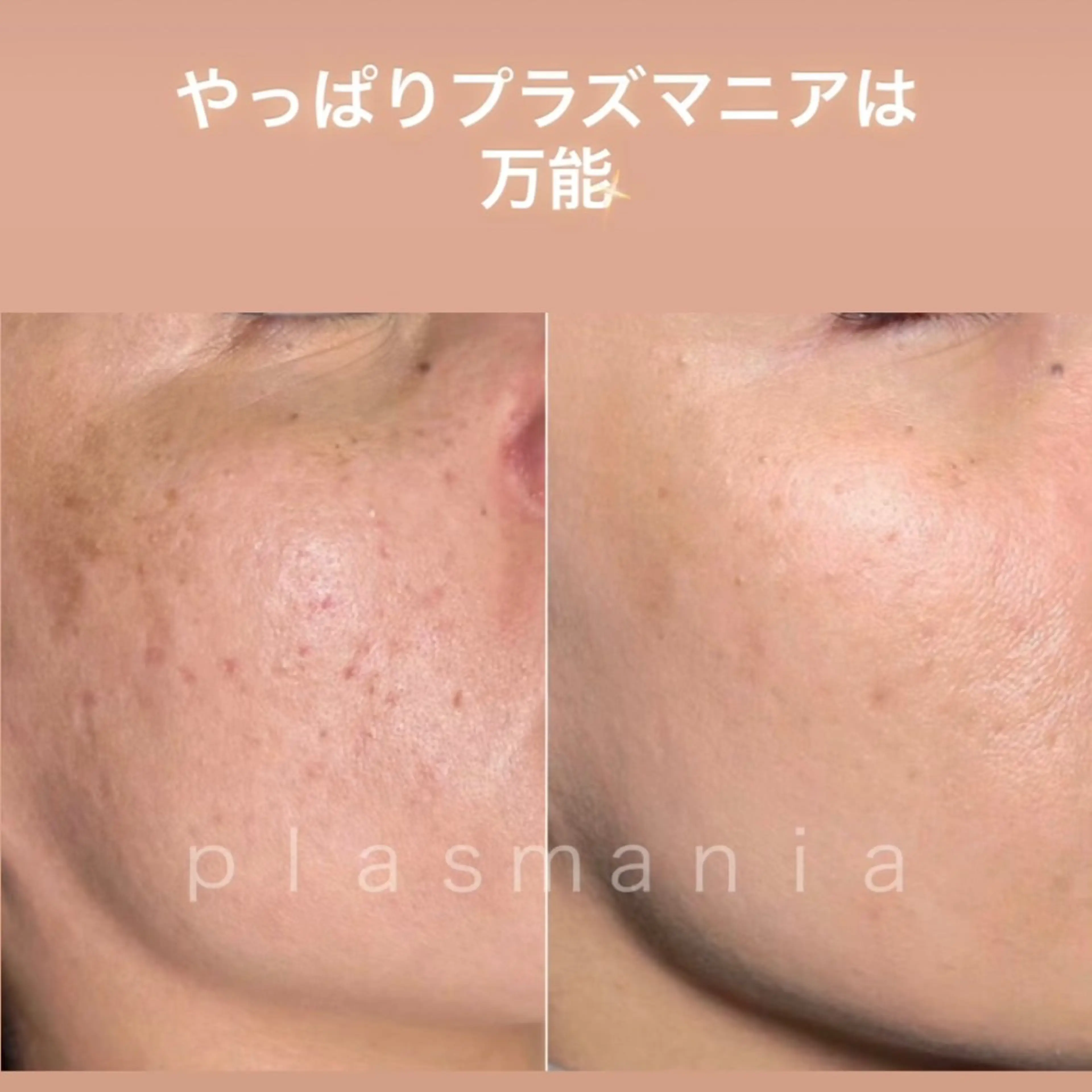 12月限定《都度払い》土台を整えて肌を育てる✨の写真