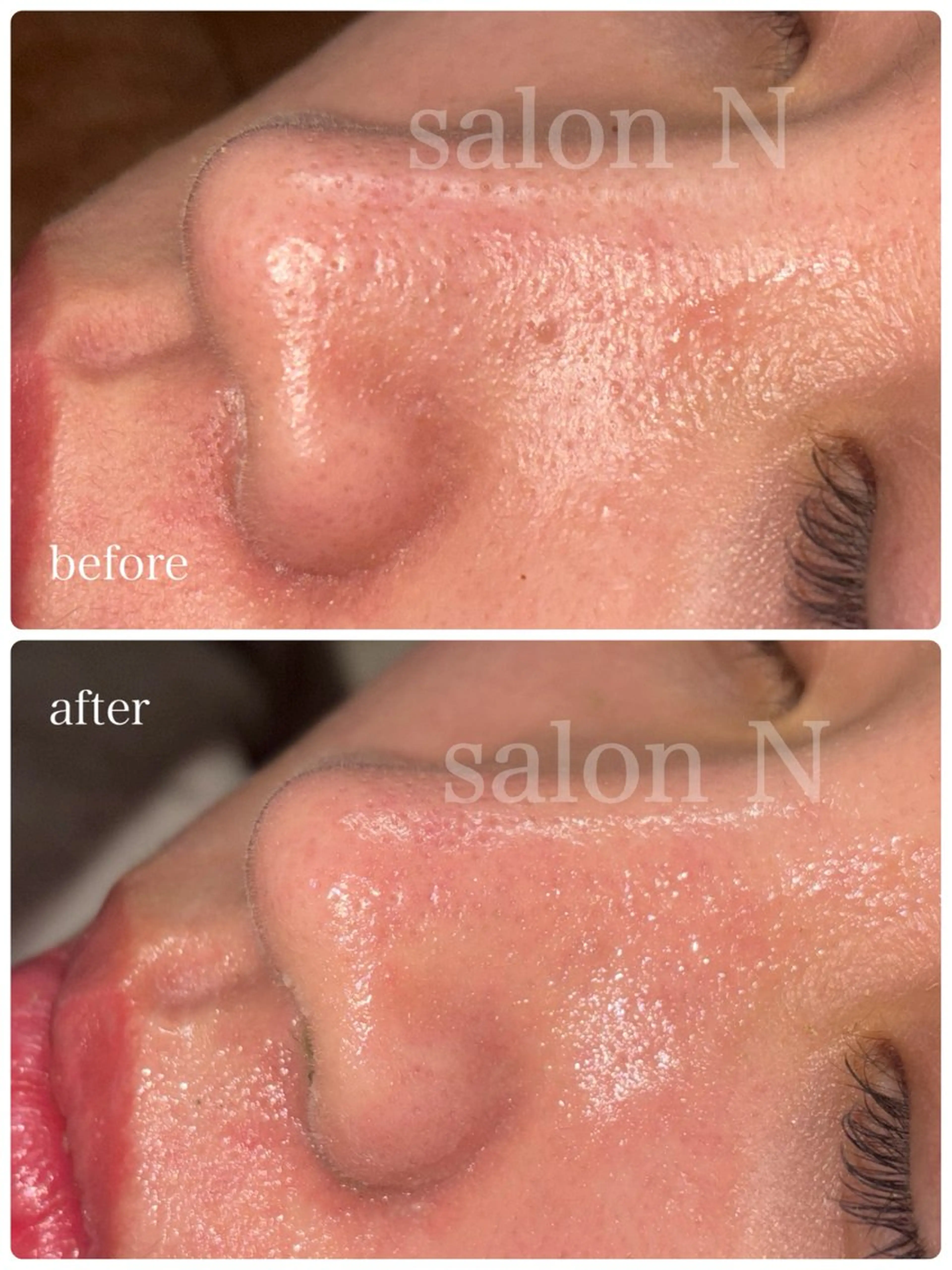 salonＮ所属・星野 マリアのエステ・リラクイメージ