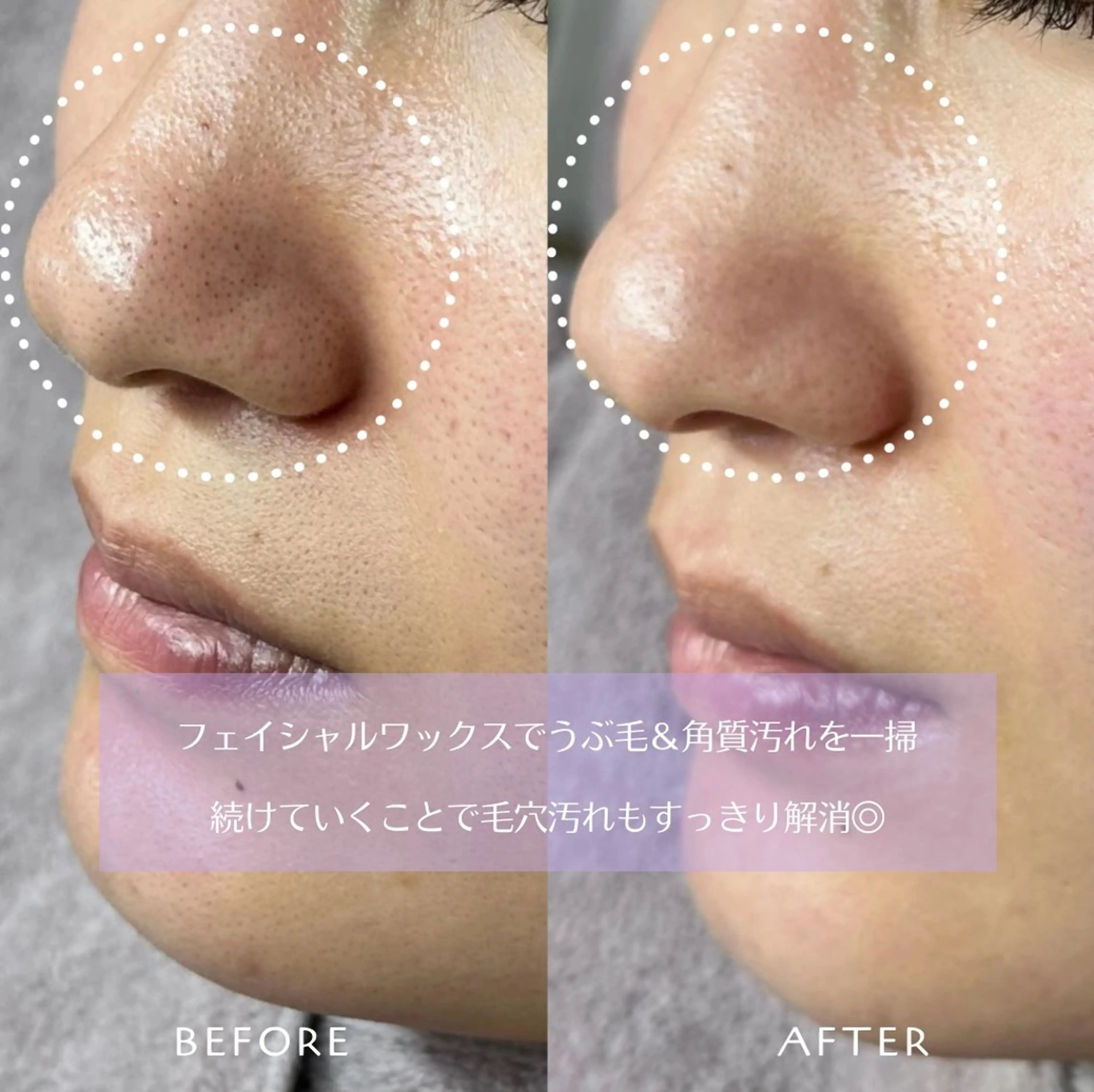 脱毛 フェイシャルワックス KANAKOのエステ・リラクイメージ