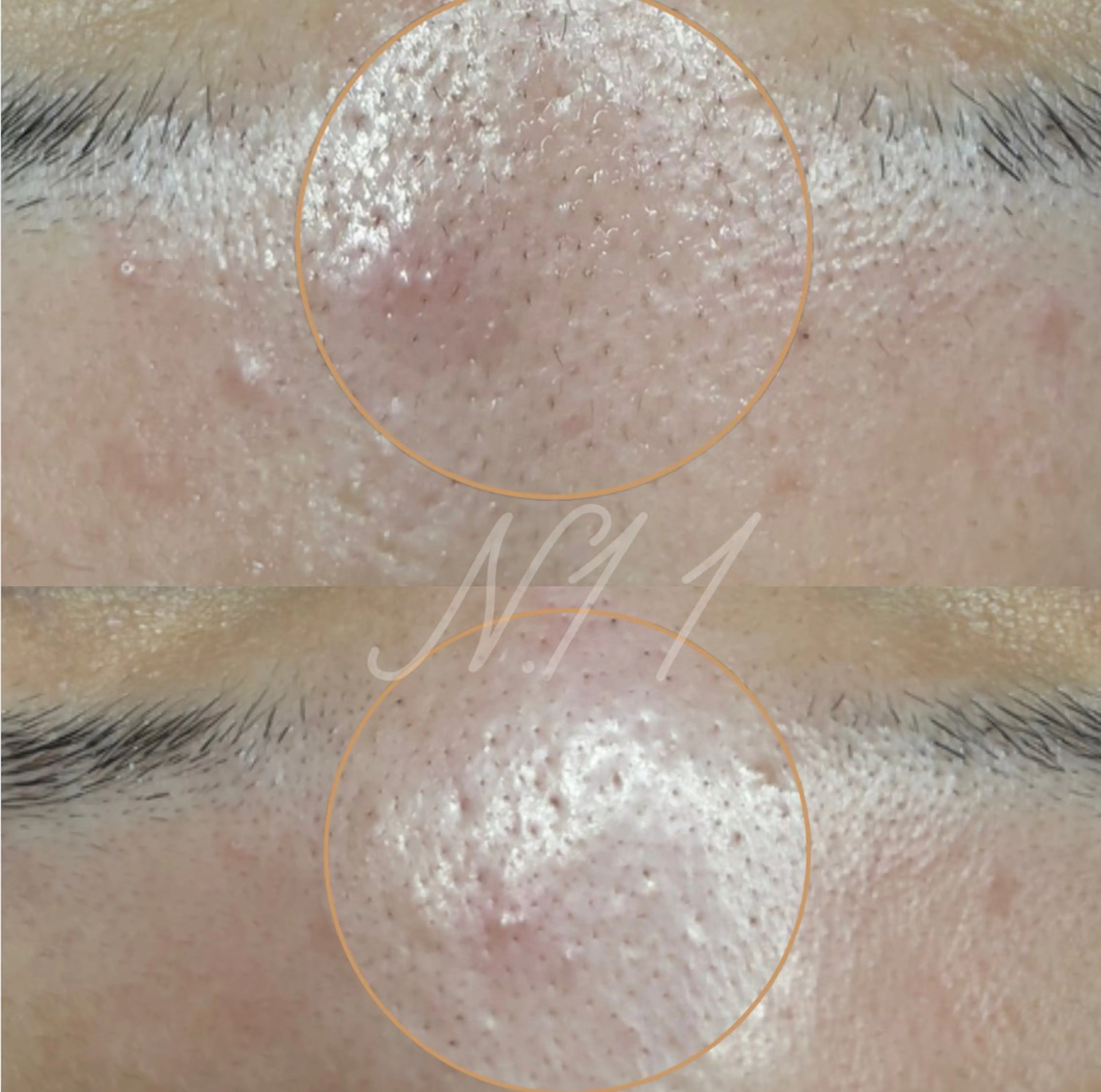 エステ beauty salon N.11所属・beauty salonN.11のエステ・リラクイメージ