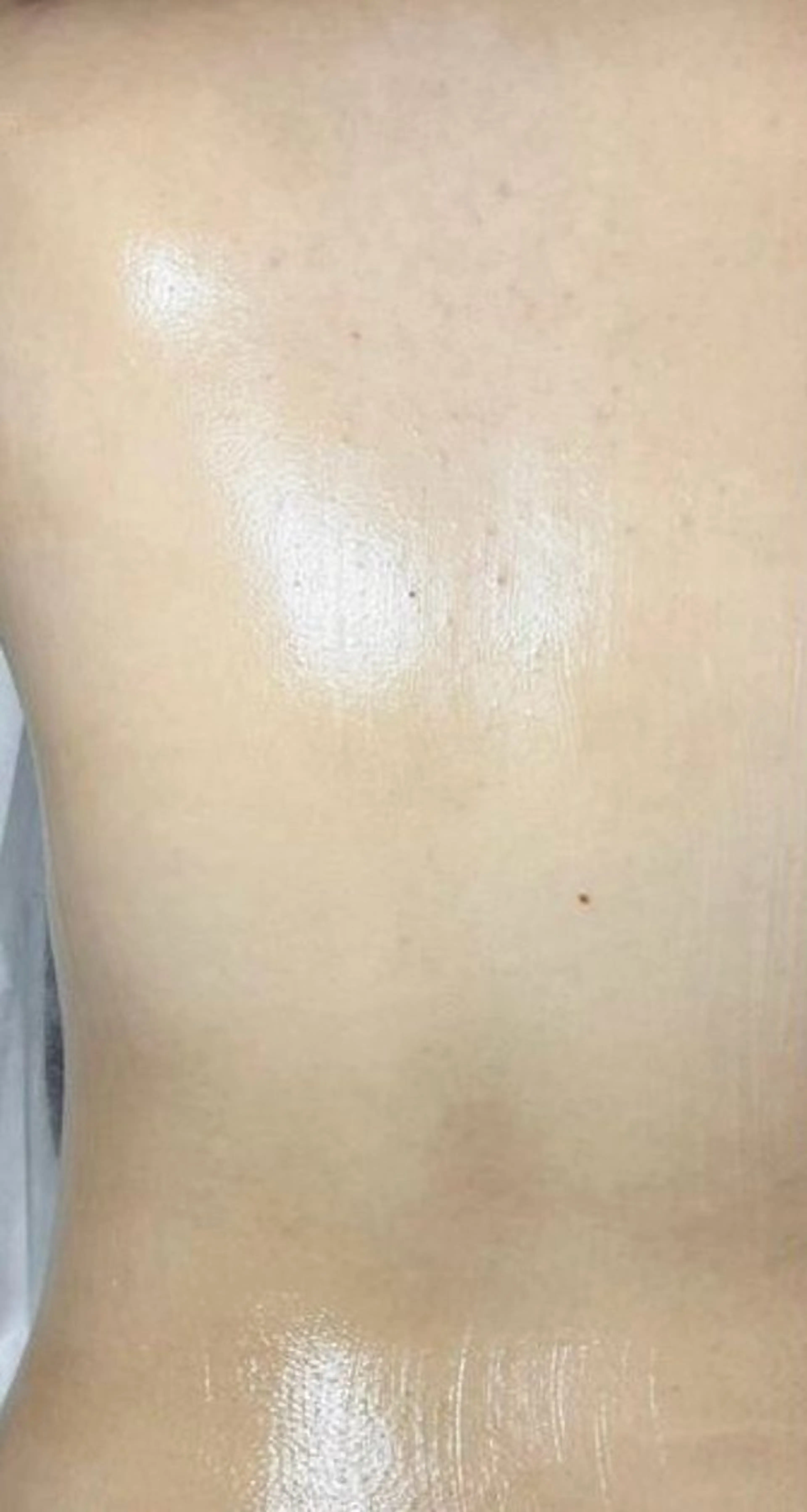 VANILLA SKY所属・VANILLA SKYのエステ・リラクイメージ