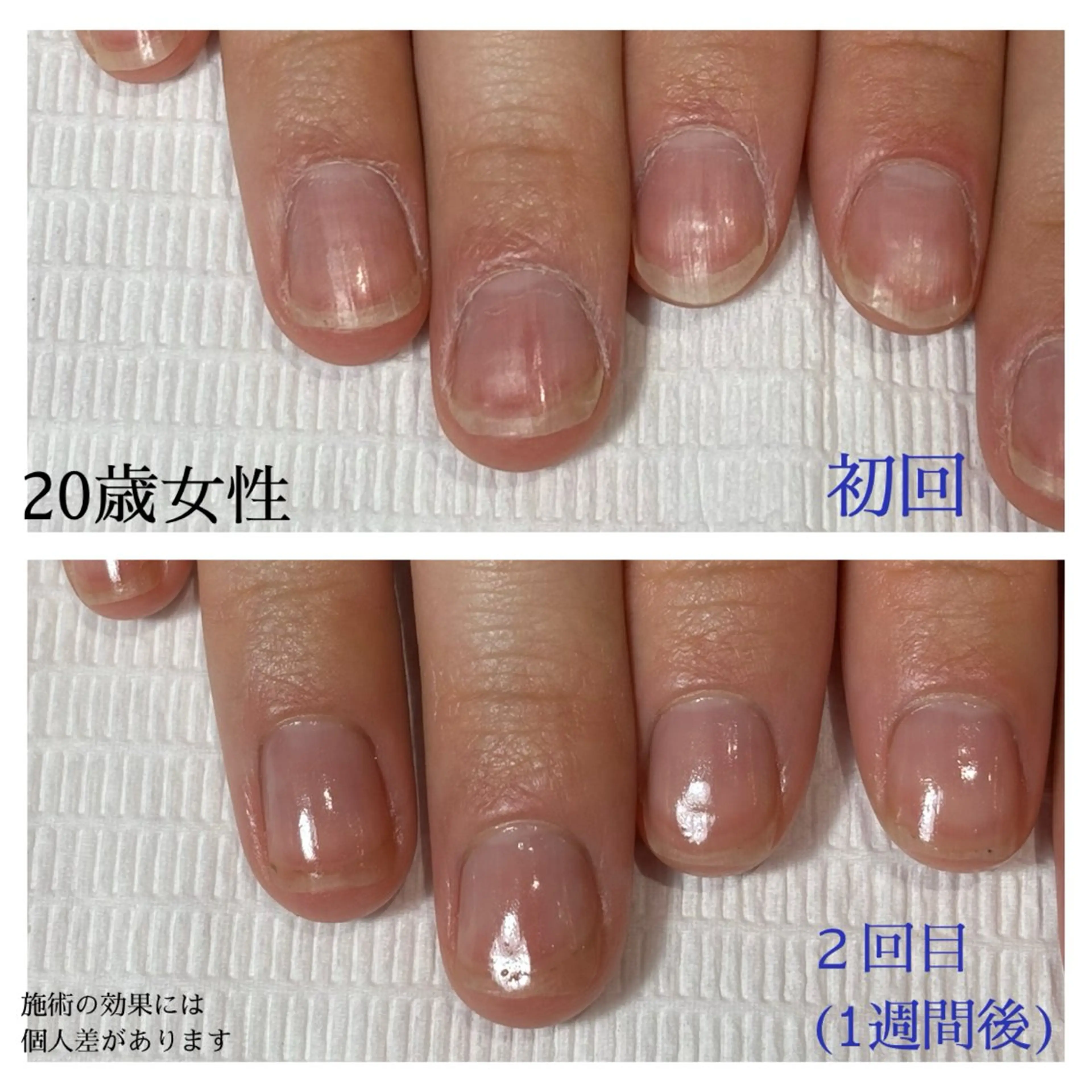 ネイル 自爪育成専門サロン エムロードゥ池下のネイルデザイン