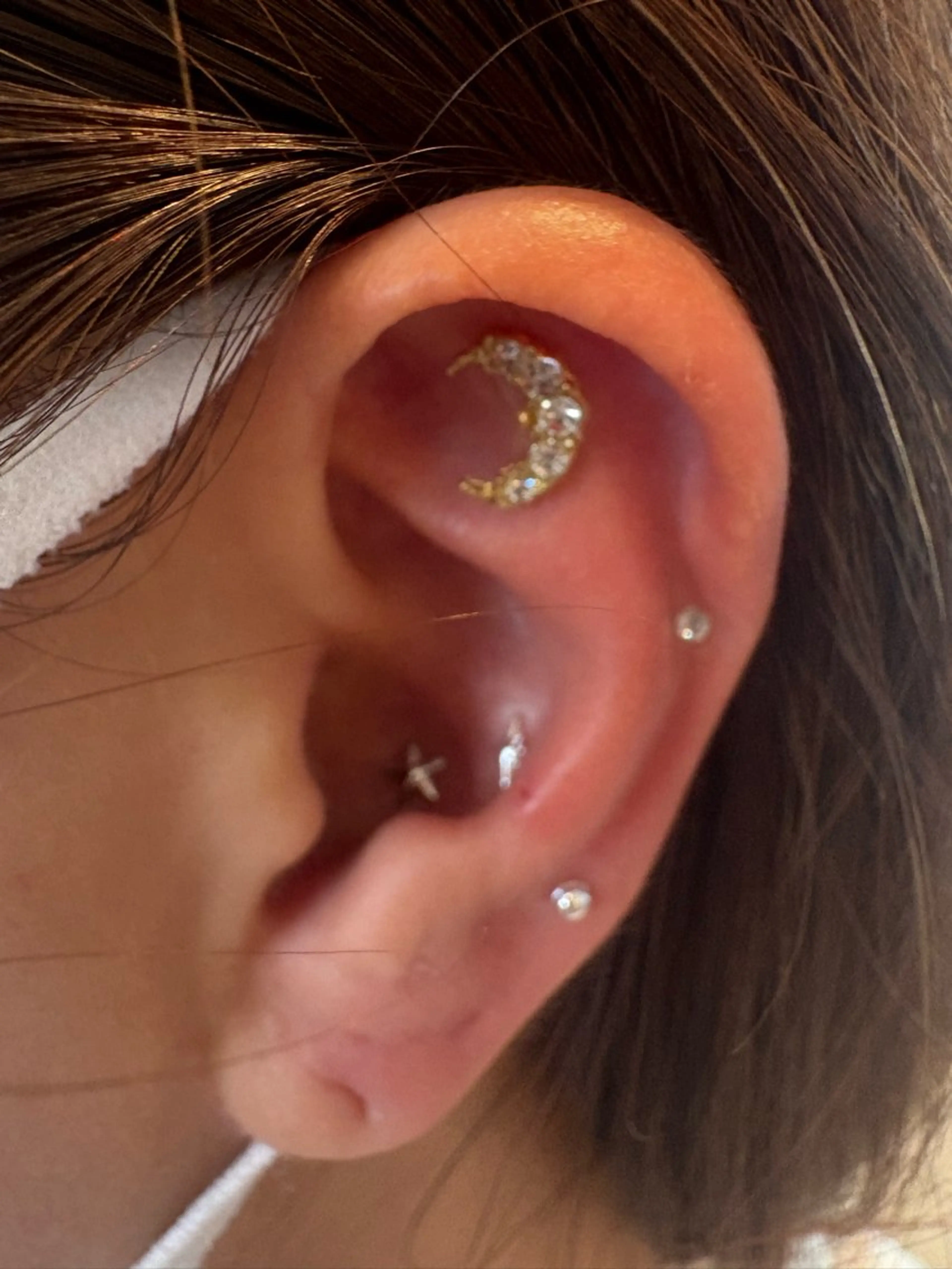 フェイシャル/毛穴 /シミ/たるみ東灘区のエステ・リラクイメージ