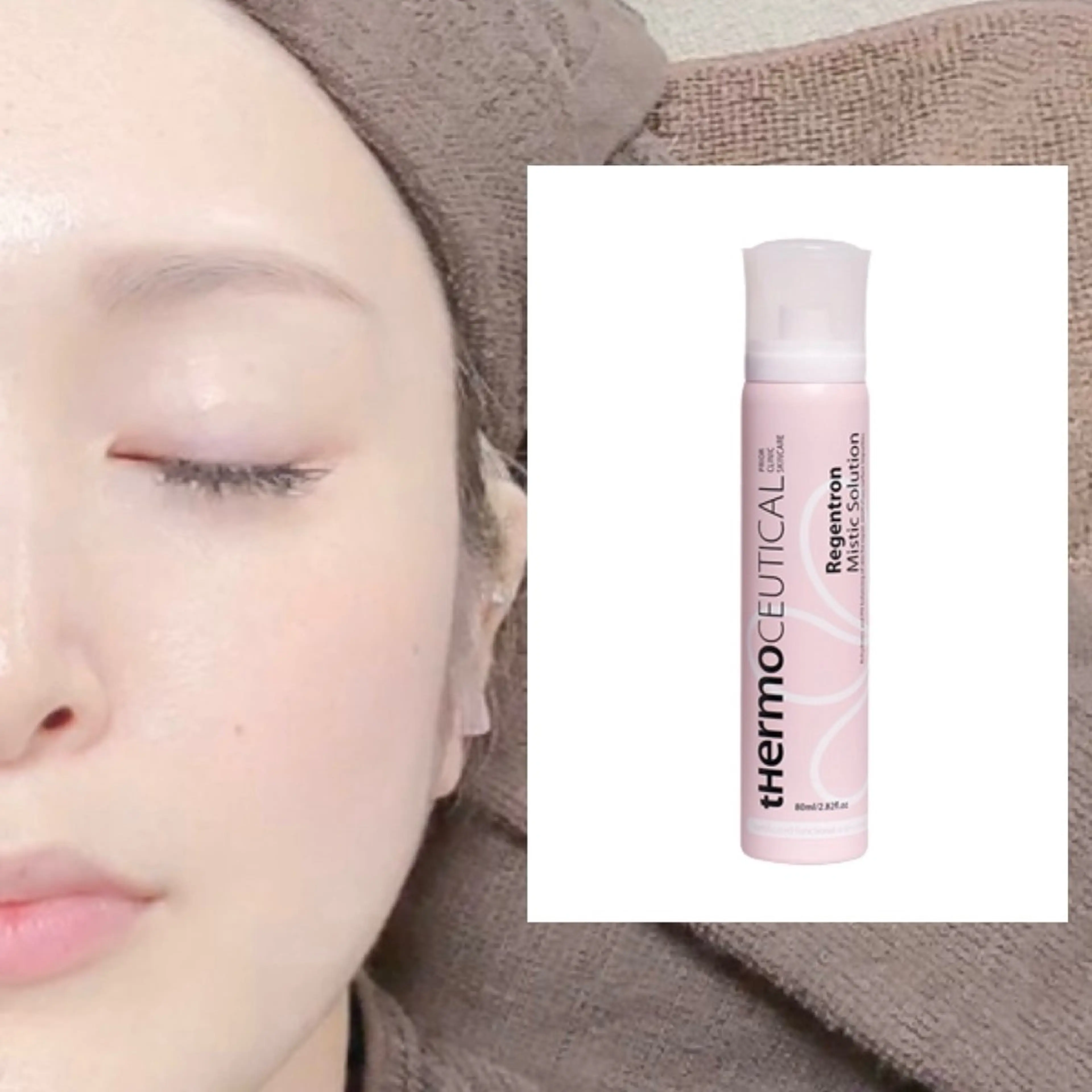 ミニモ限定🌸《剥離あり》ハーブピーリング🌿‬‬＋【ホームケア】ミストローション1本付き❣️メンズ歓迎✨🤗✨の写真