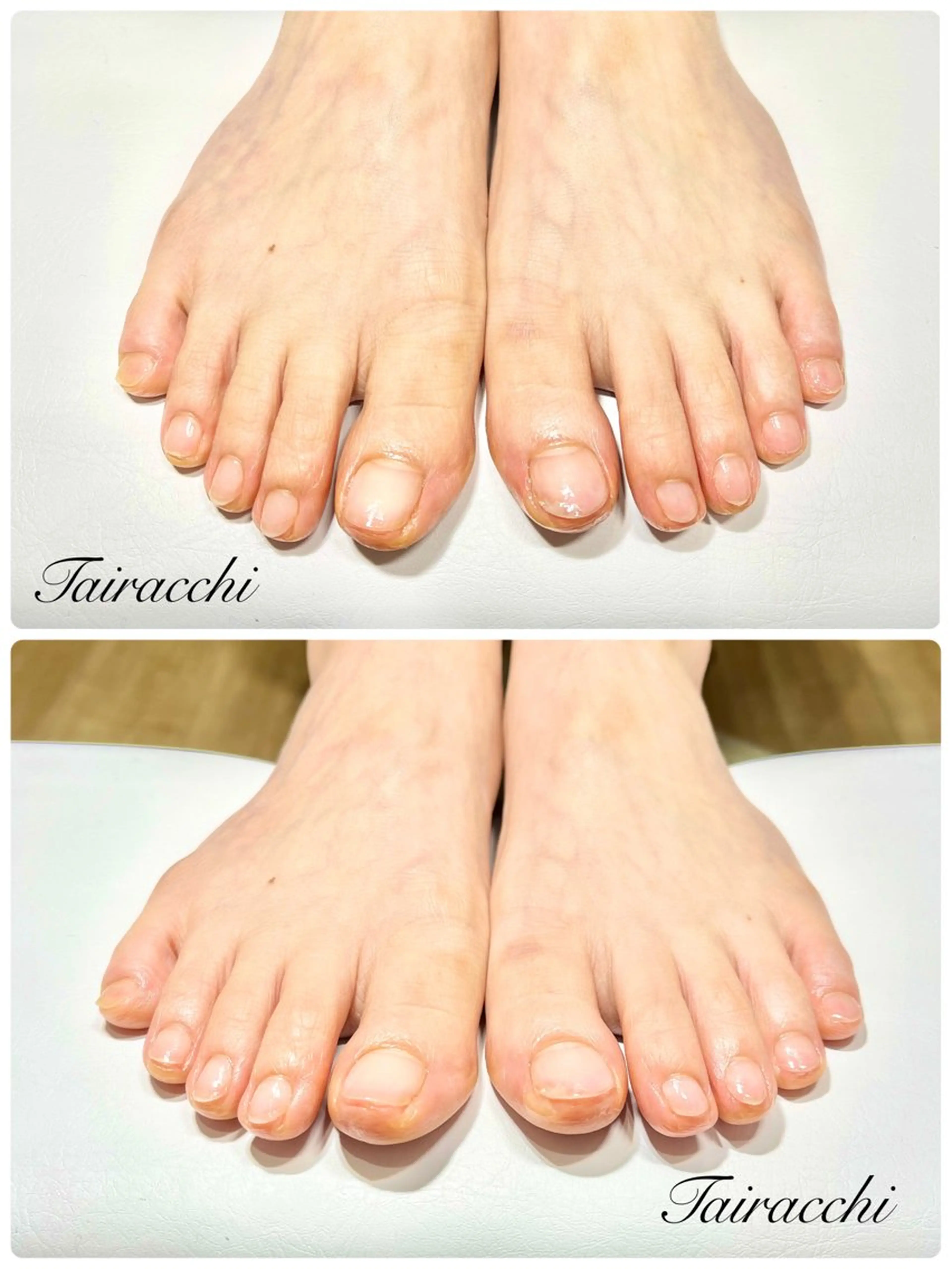 ネイル フットネイル ジェルネイル フットネイル Tairacchi ﾀｲﾗｯﾁのエステ・リラクイメージ