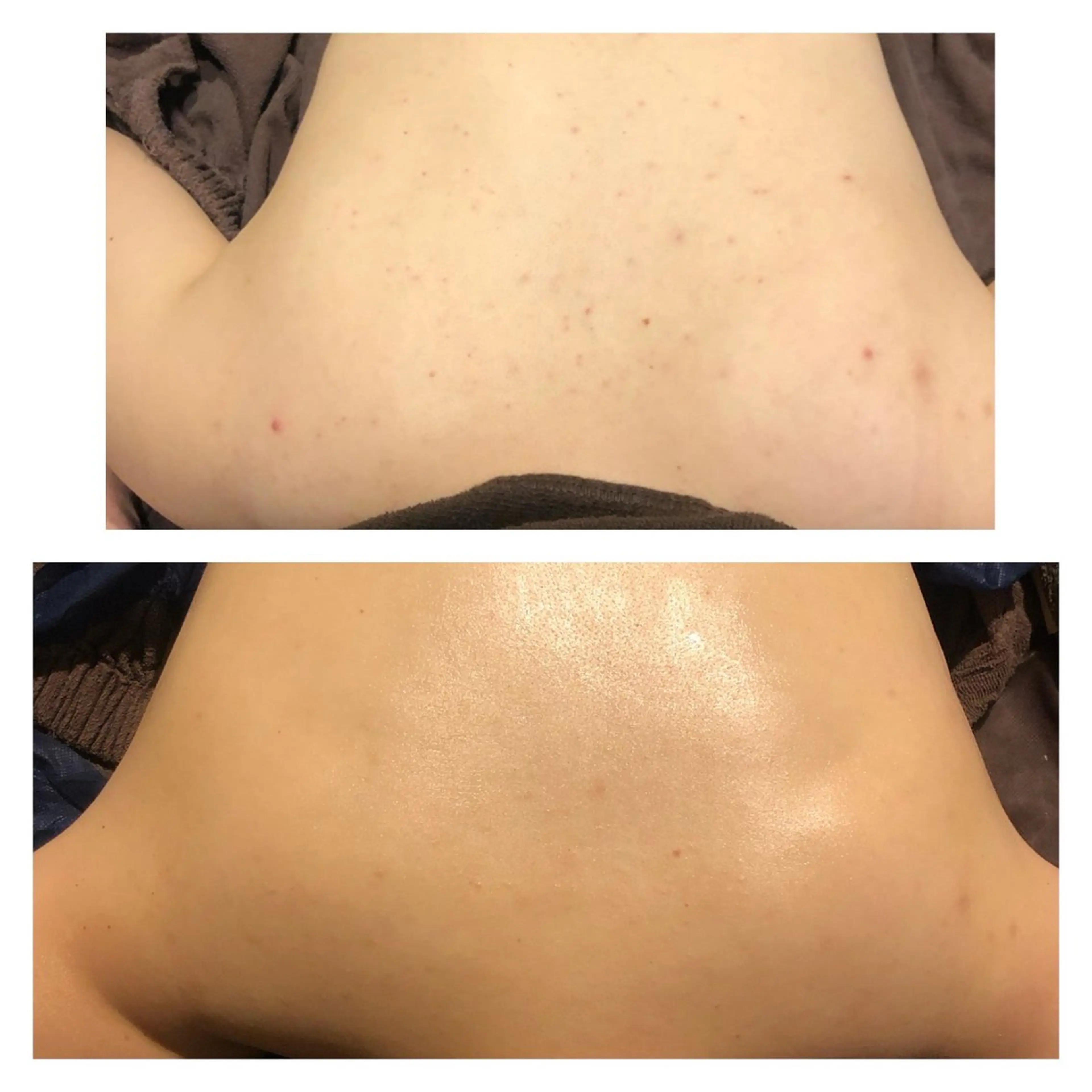 エステ 毛穴ニキビ専門 ビューティーグランツのエステ・リラクイメージ