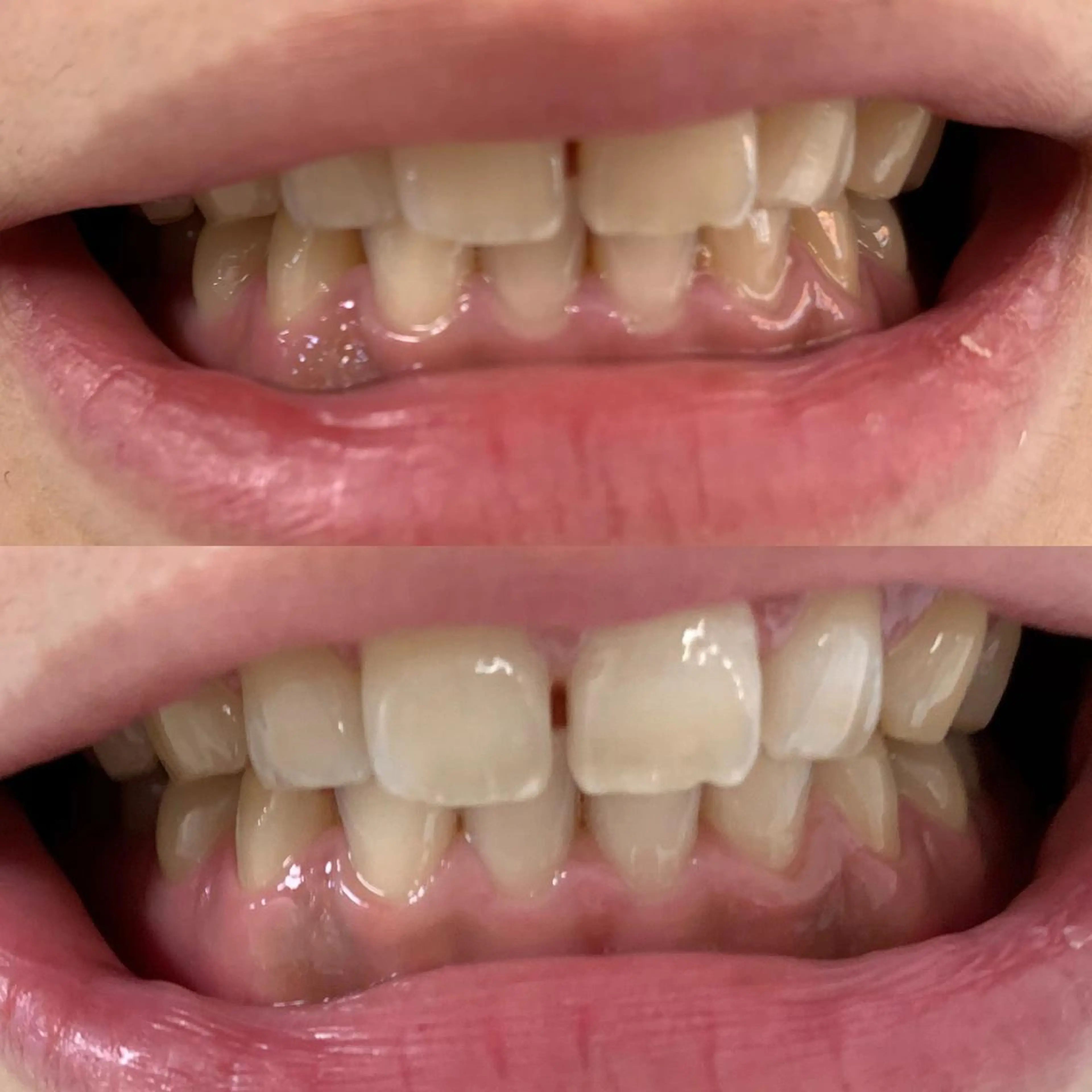 217whitening  room所属・217 ホワイトニングルームのエステ・リラクイメージ