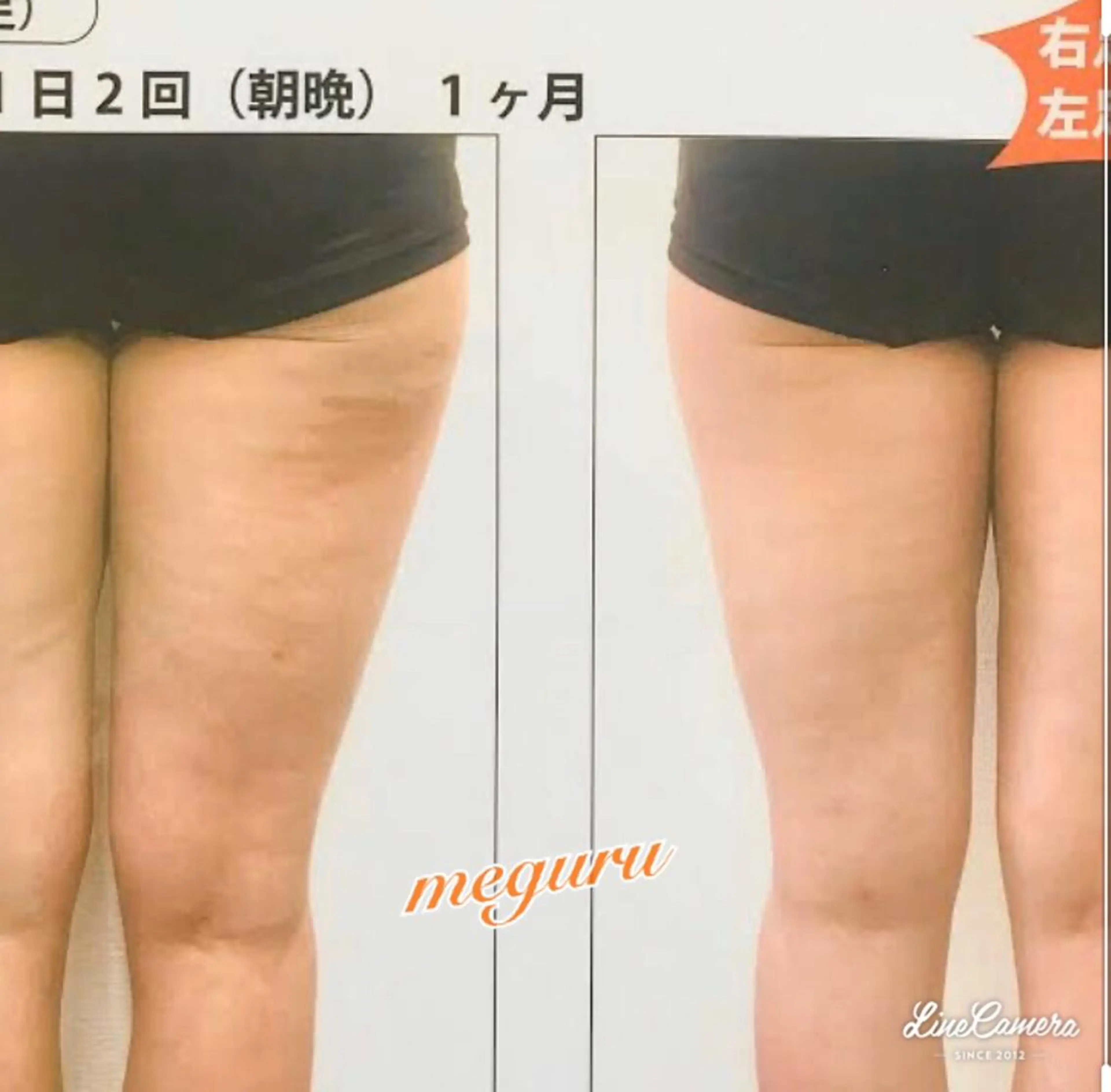 ショート カラー パーマ ヘアアレンジ メンズ キッズ ネイル マツエク・マツパ 小顔カット ストーンネイル エステ リラク 痩身&ボディ 結果出し🌟丹野のエステ・リラクイメージ