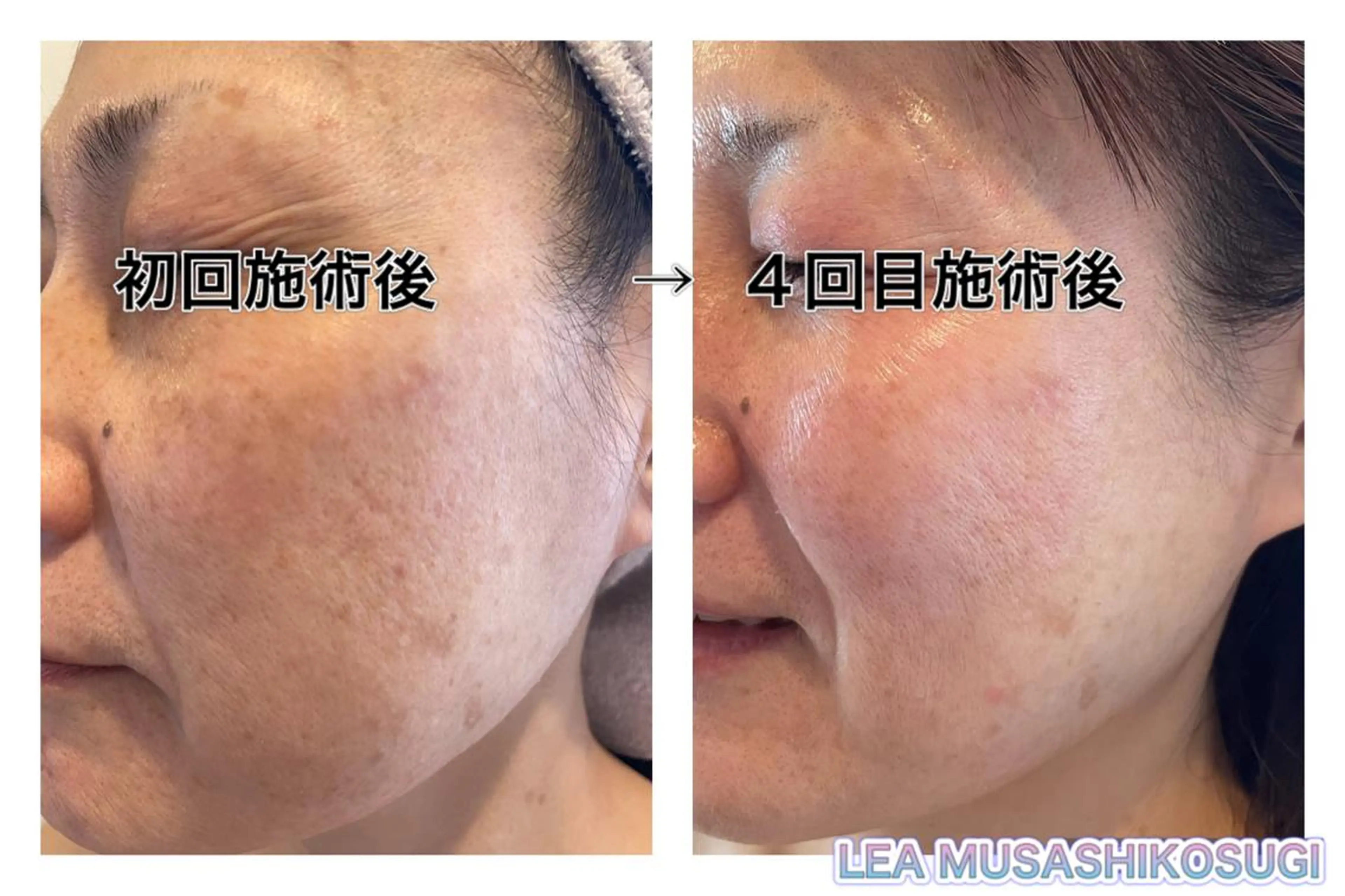 LEA MUSASHIKOSUGI所属・美肌育成サロン LEA武蔵小杉のエステ・リラクイメージ