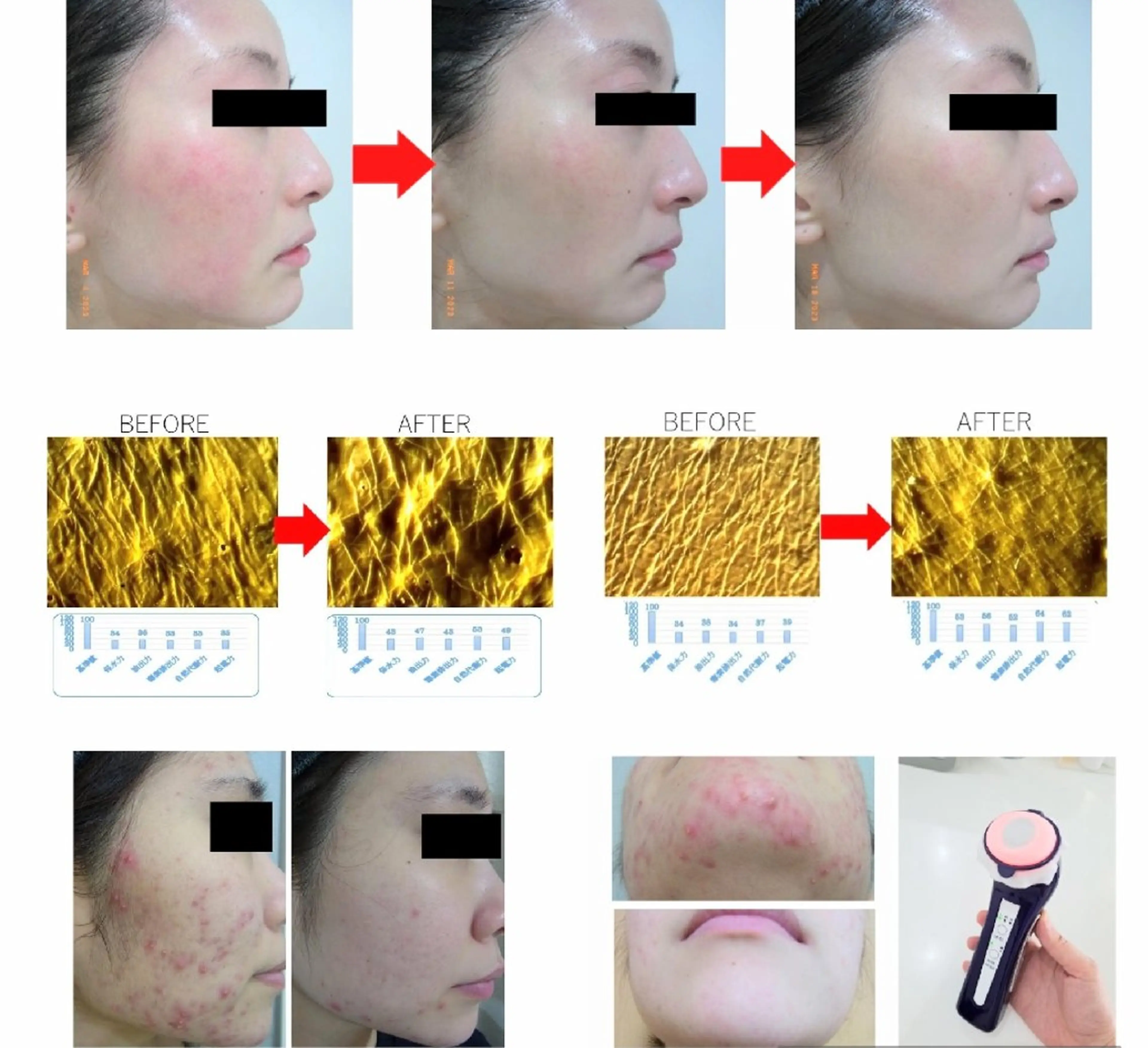 【学生限定】パーソナライズケアの写真