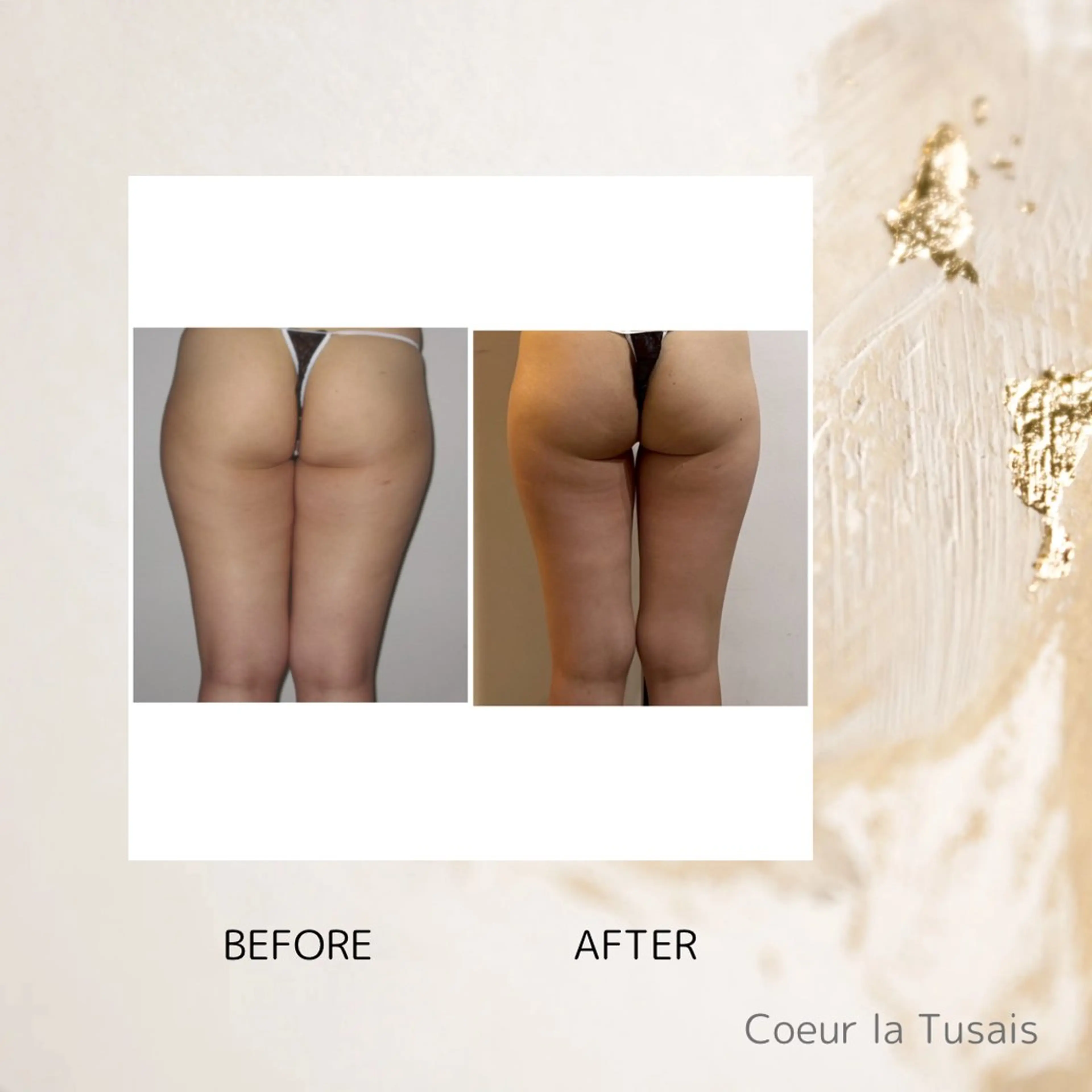 ヒップアップコースの写真