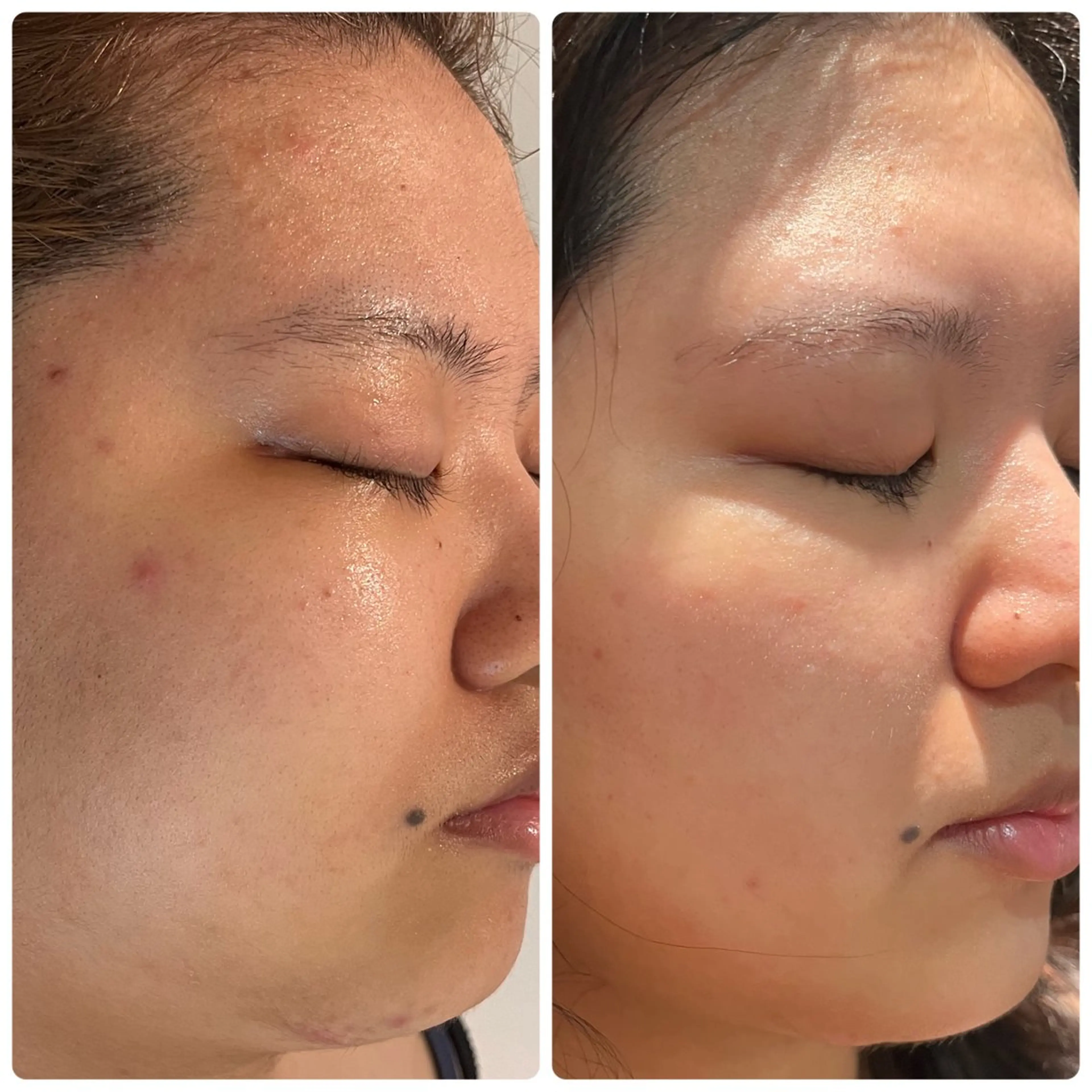 ナリスビューティーサロン池袋店所属・スズキ マイのエステ・リラクイメージ