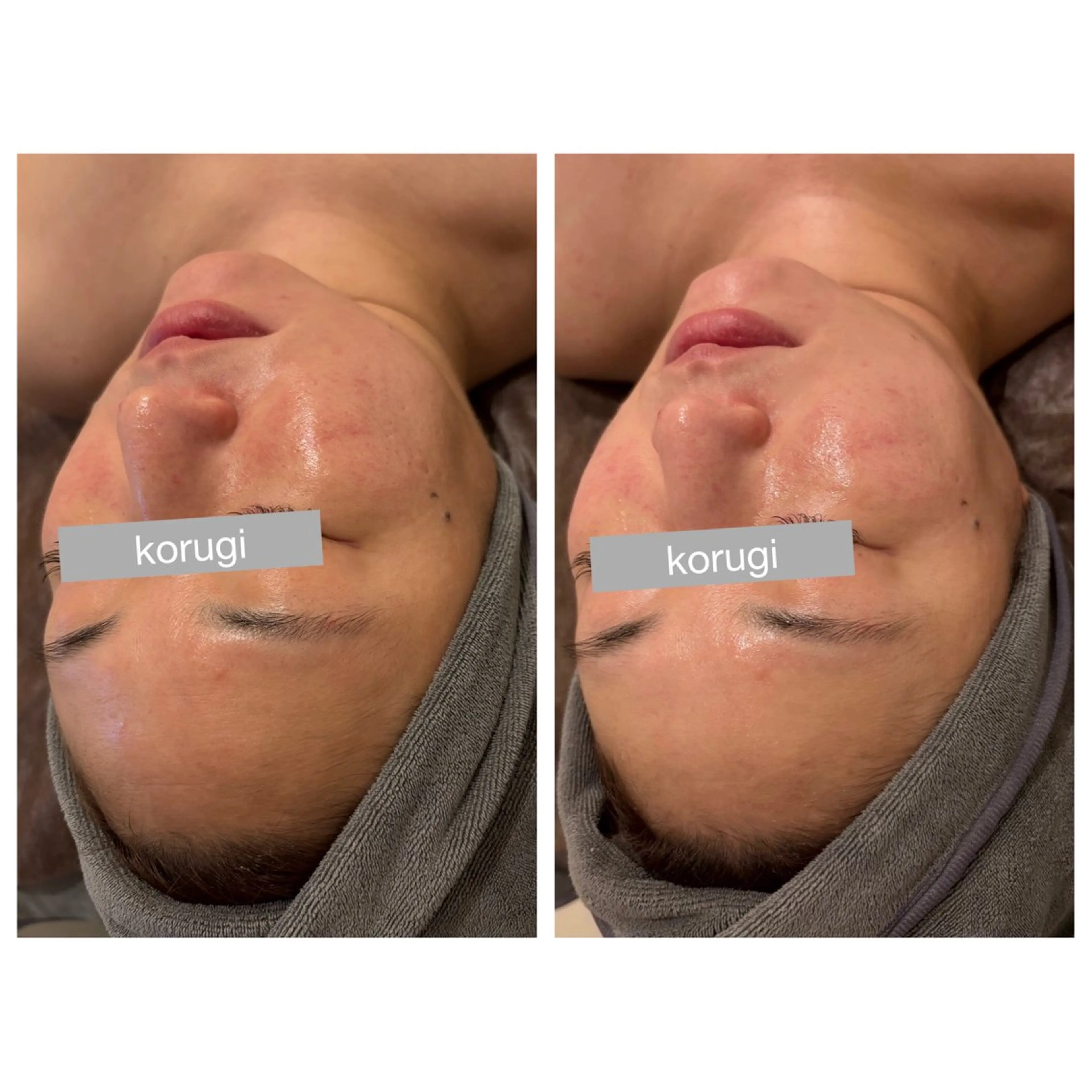 ☆痩身/小顔☆ コルギのエステ・リラクイメージ