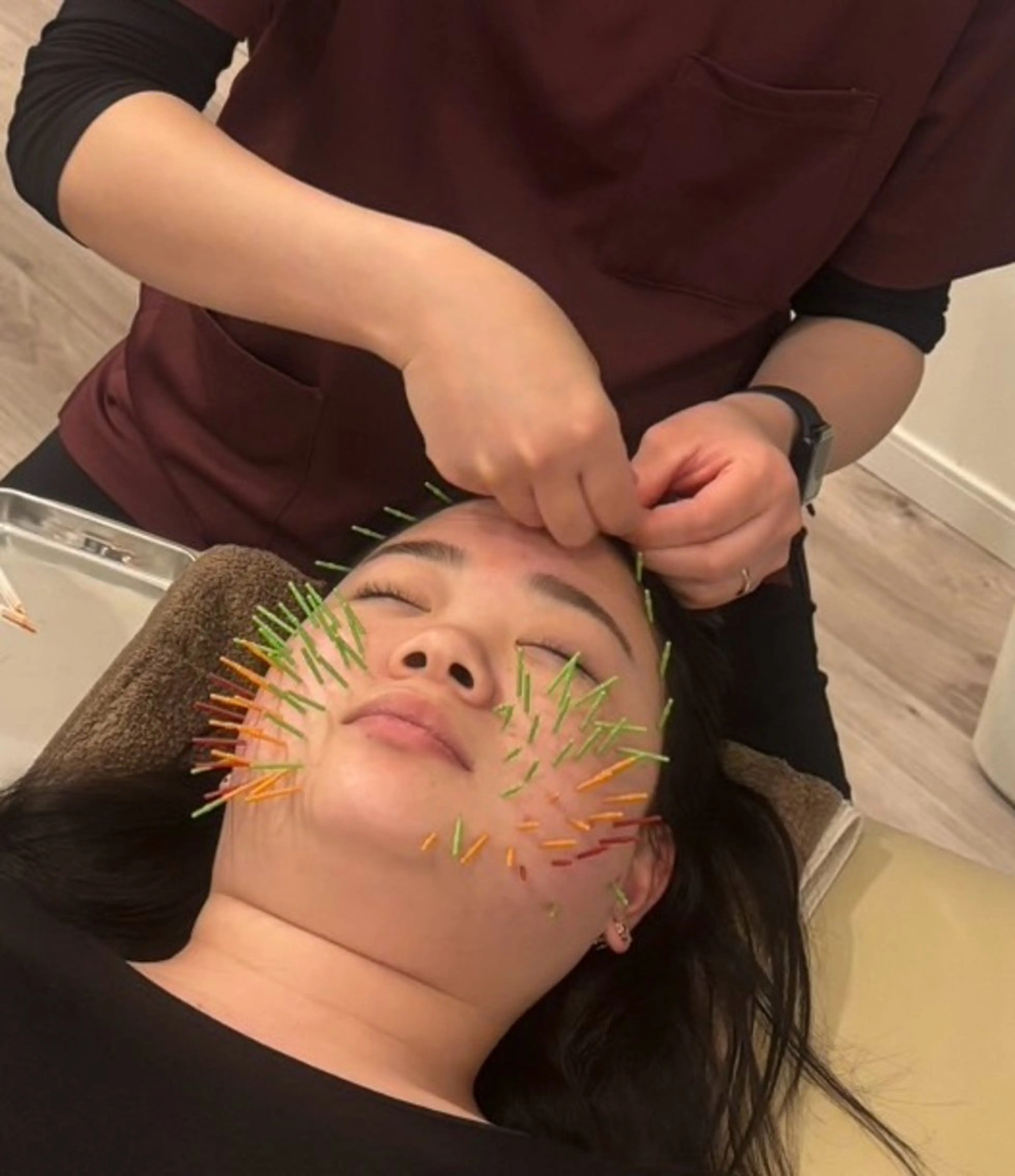 エステ リラク 美容鍼灸Solana所属・肌質改善×美容鍼 ゆいのエステ・リラクイメージ