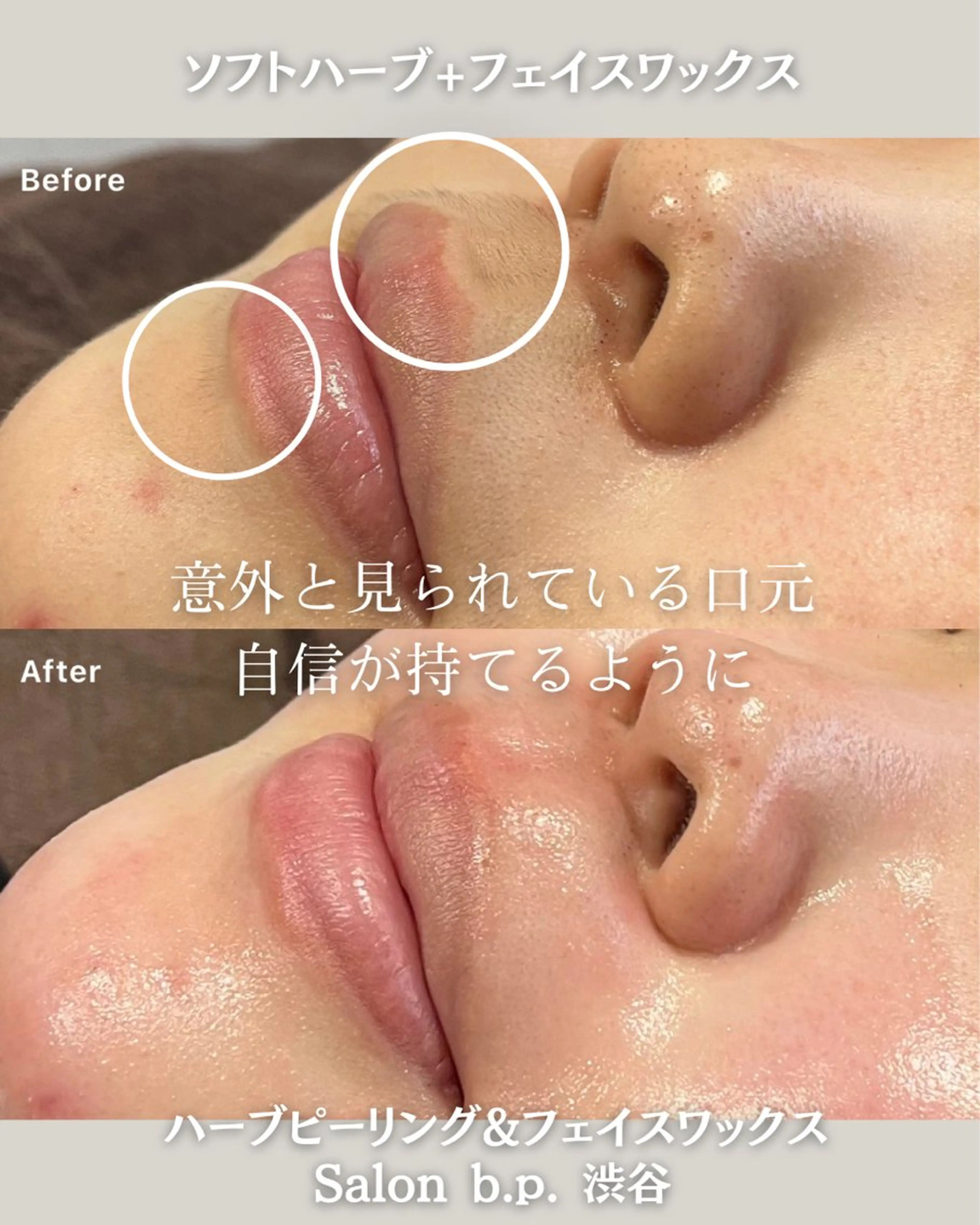 Salon b.p. 渋谷🤍Rinのエステ・リラクイメージ