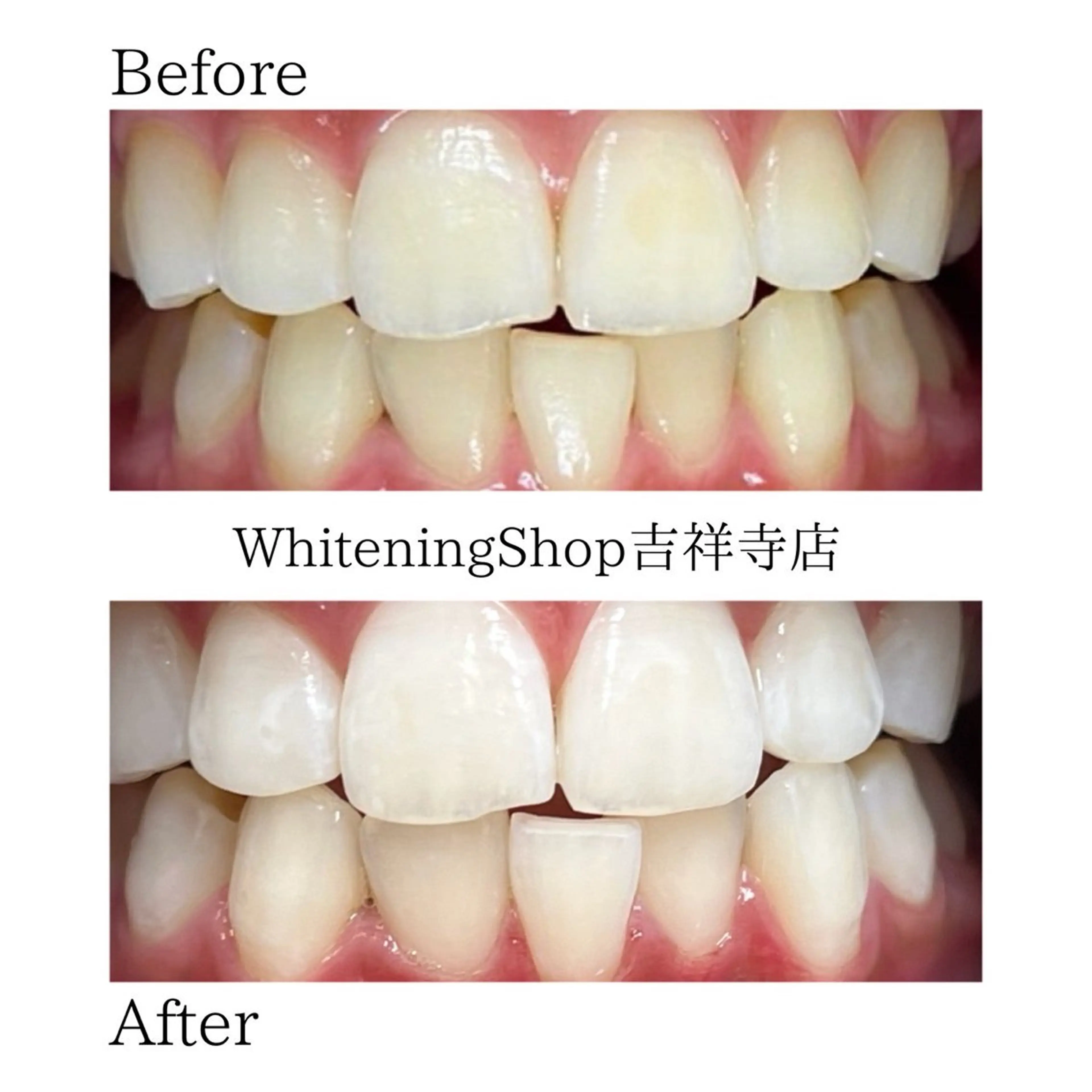 エステ リラク ホワイトニング ショップ吉祥寺店のエステ・リラクイメージ