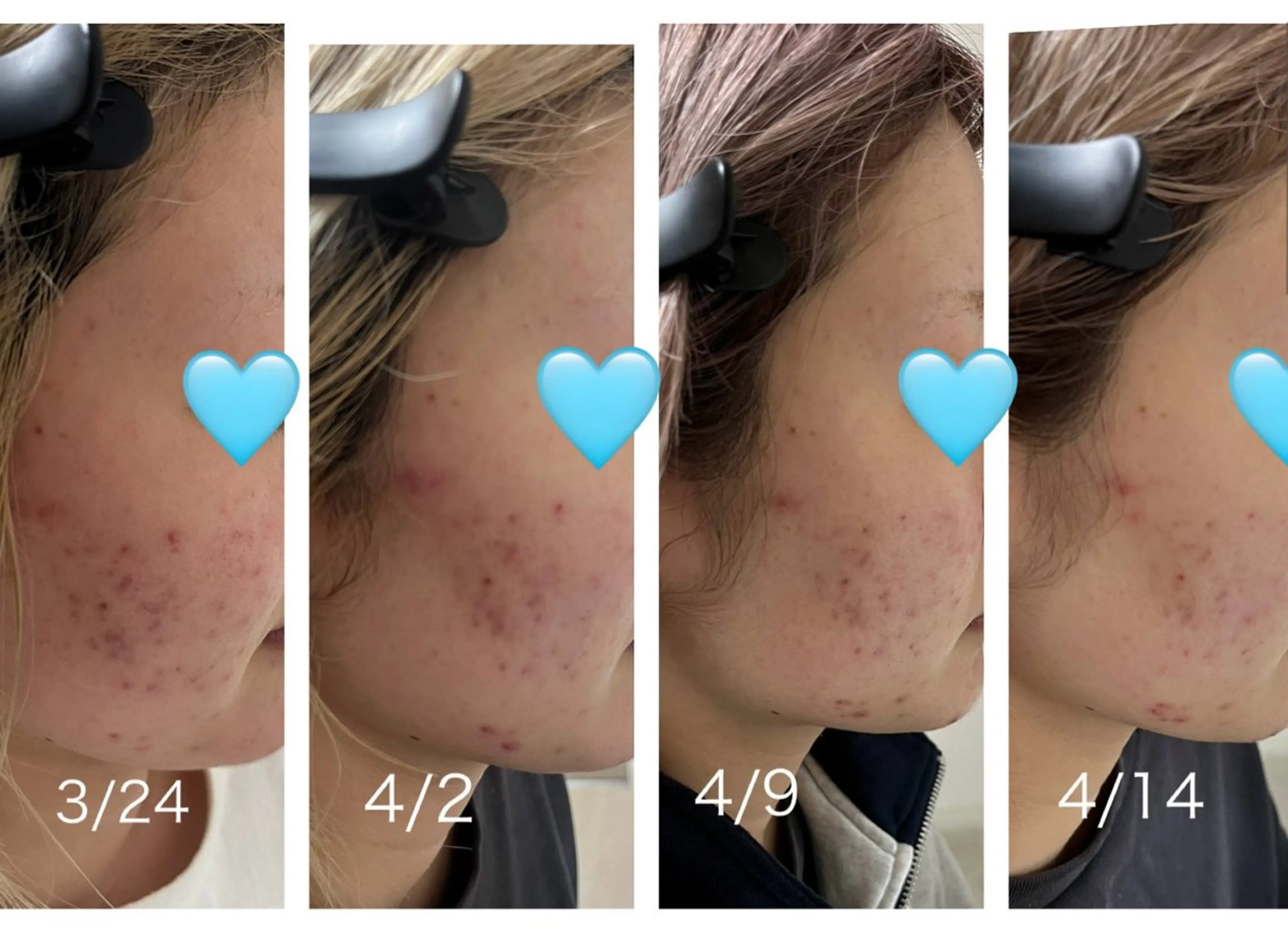 緋田 瑞穂のエステ・リラクイメージ