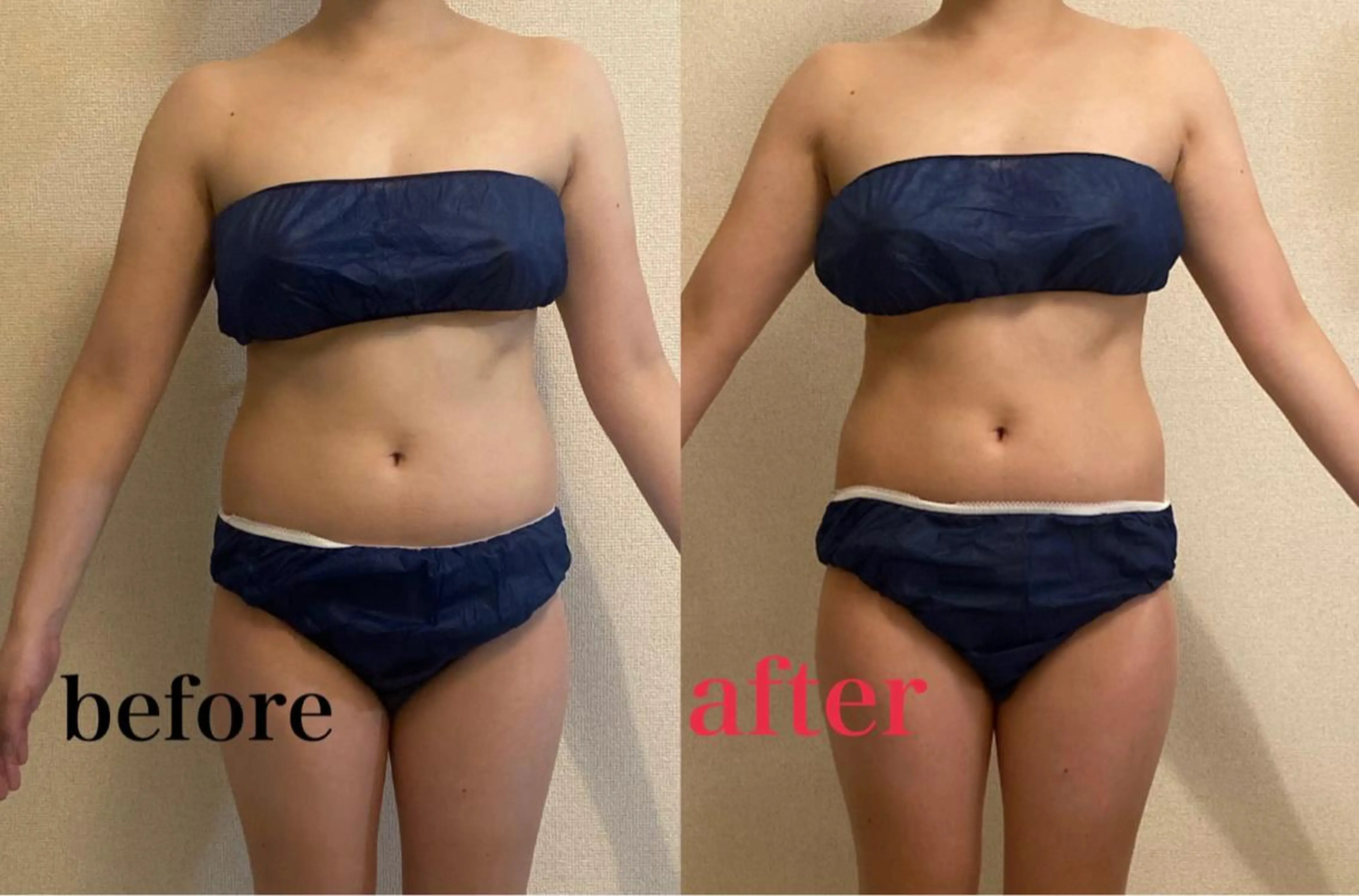 エステ リラク Salon de Lino 御器所のエステ・リラクイメージ