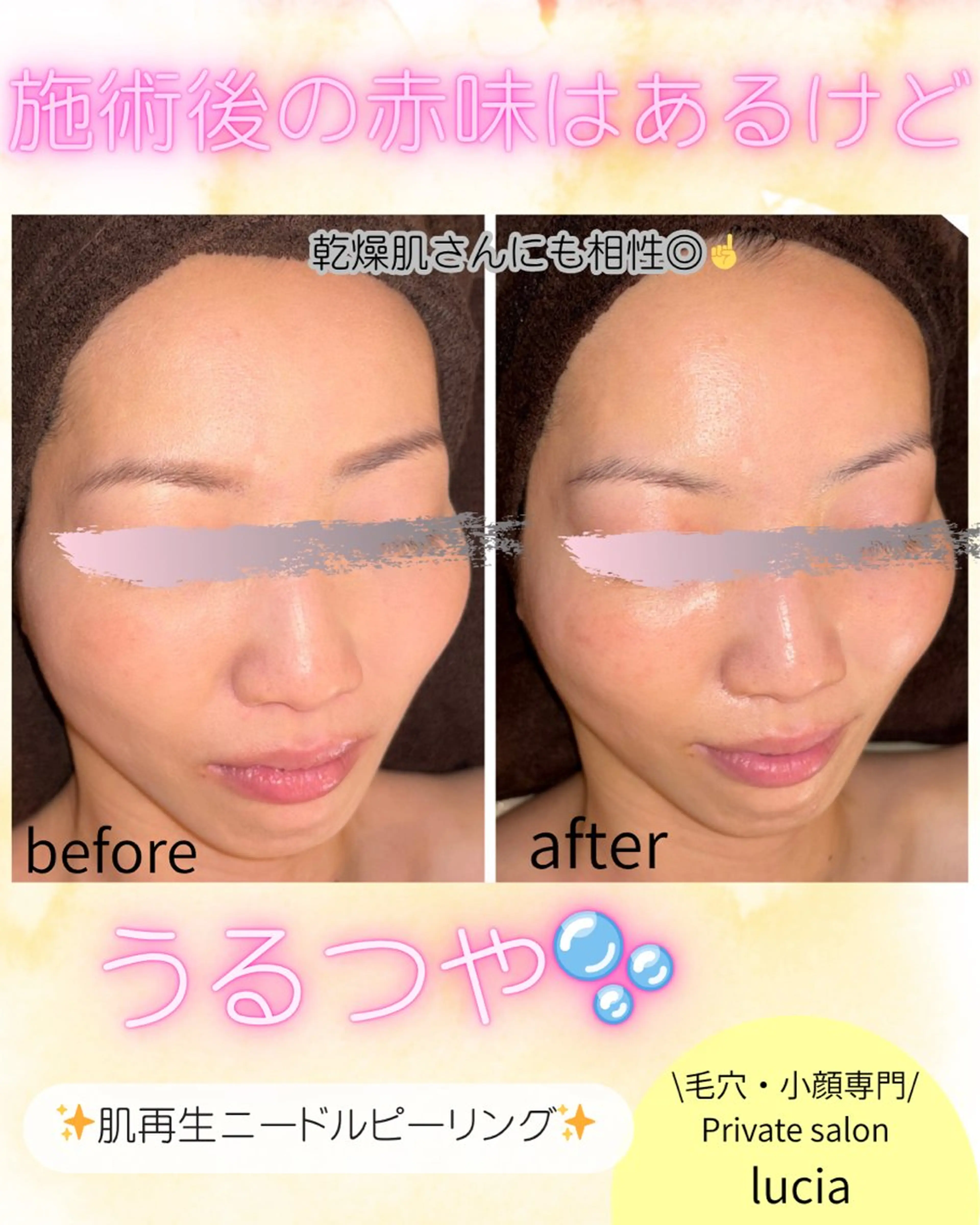 エステ ビューティーサロンルシア所属・lucia  豊明 肌管理のエステ・リラクイメージ