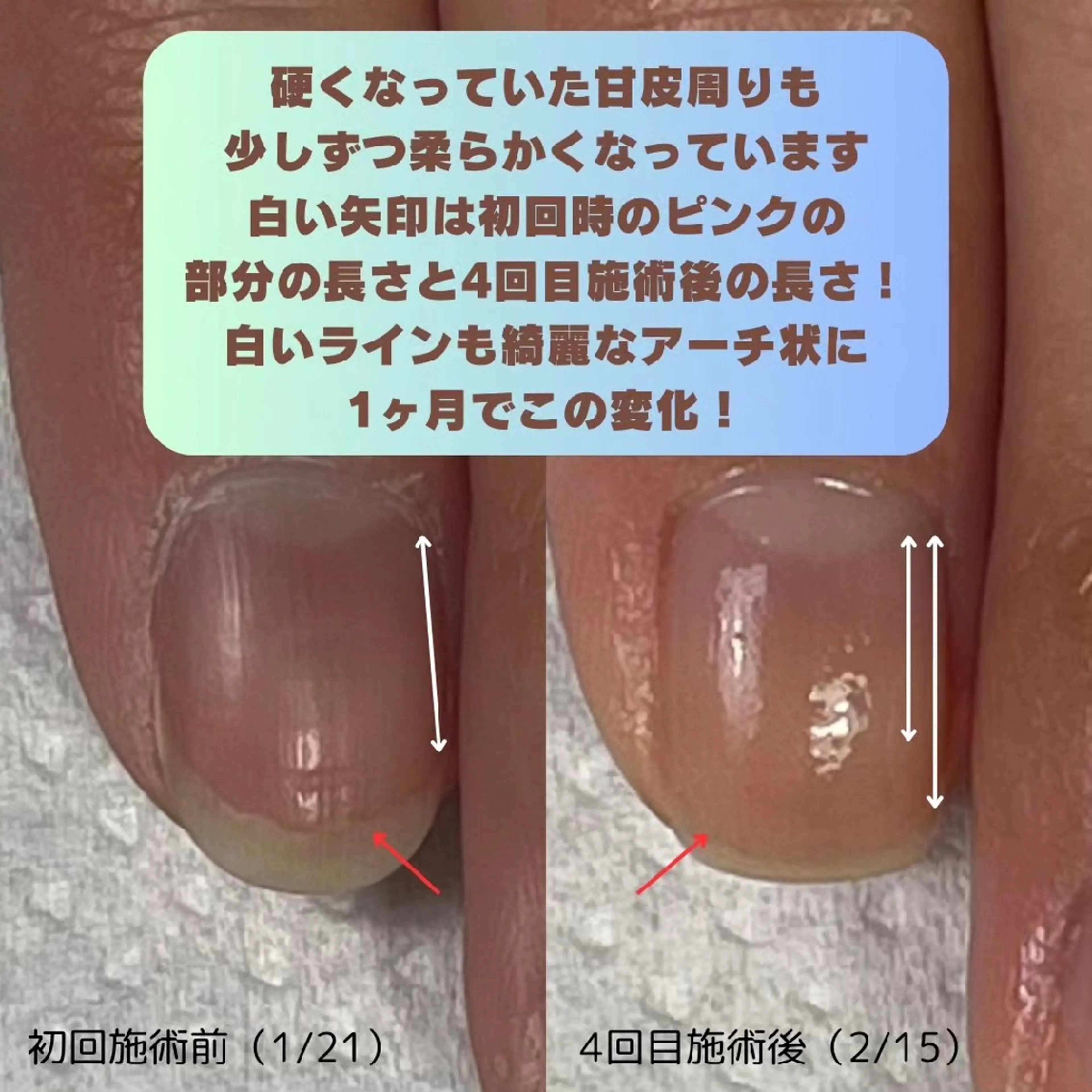 ネイル nail 1623のネイルデザイン