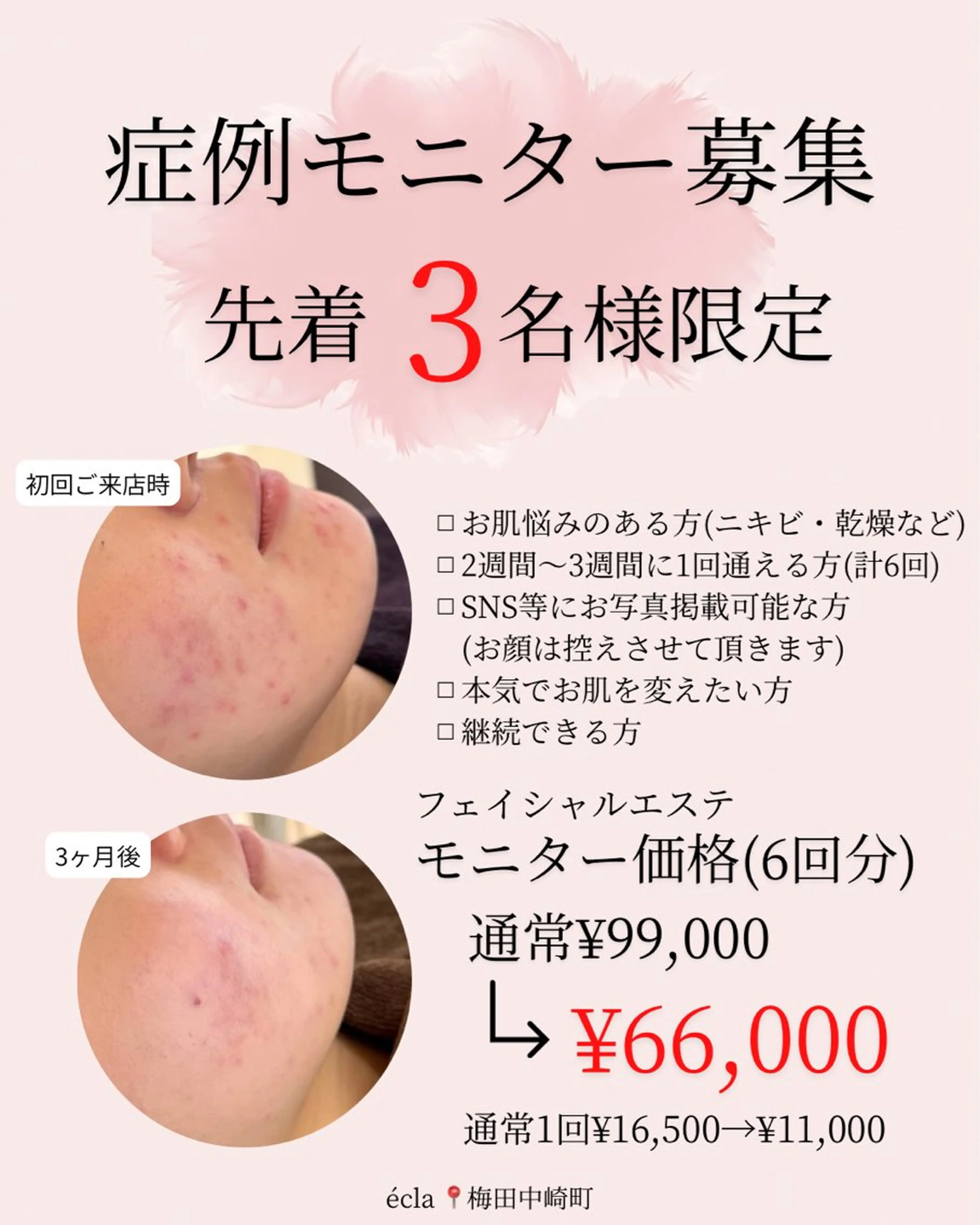 エステ écla【中崎町】 yukikoのエステ・リラクイメージ