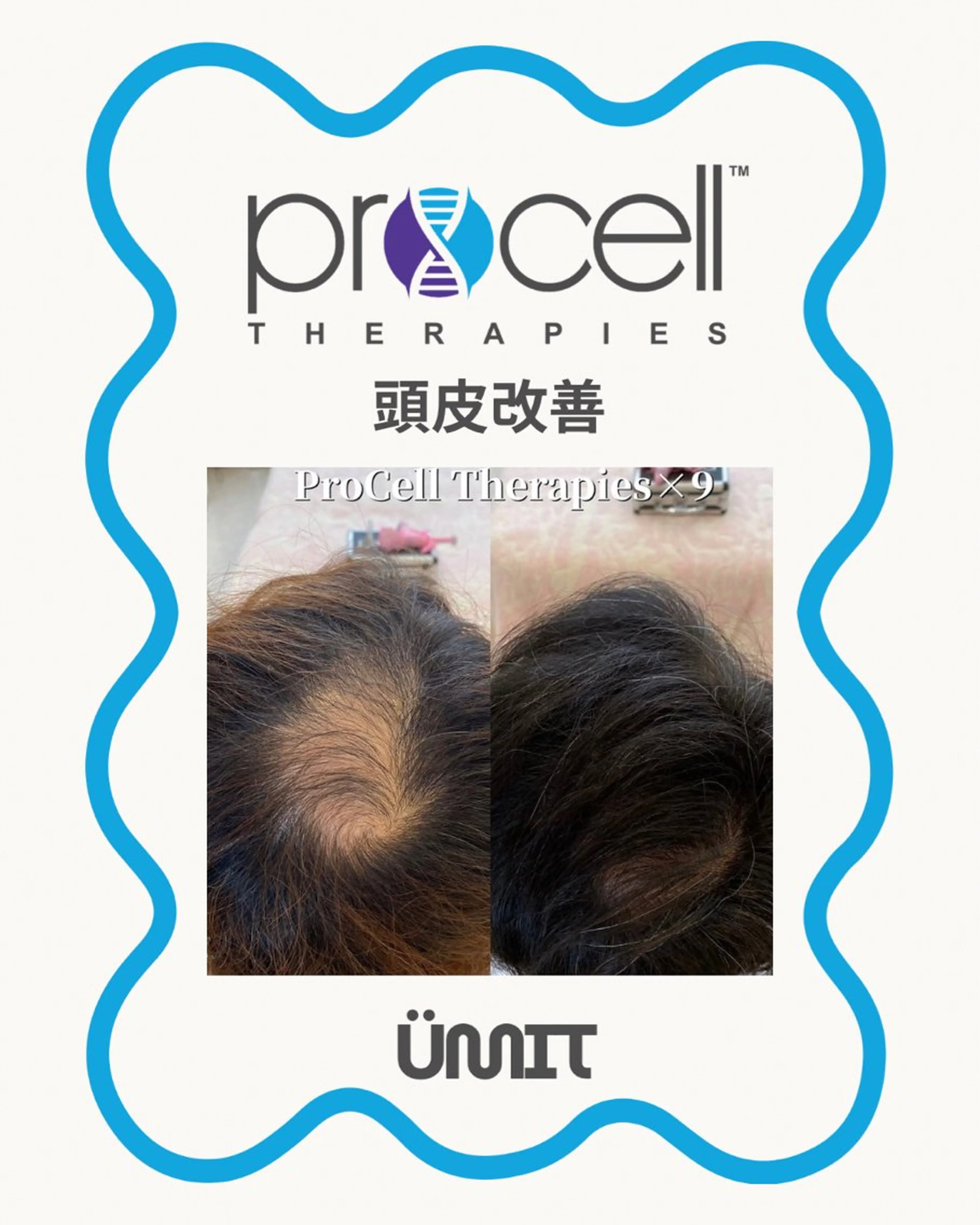 メンズ ヘッドスパ Ümit（ユミト） プロセルセラピーズのネイルデザイン