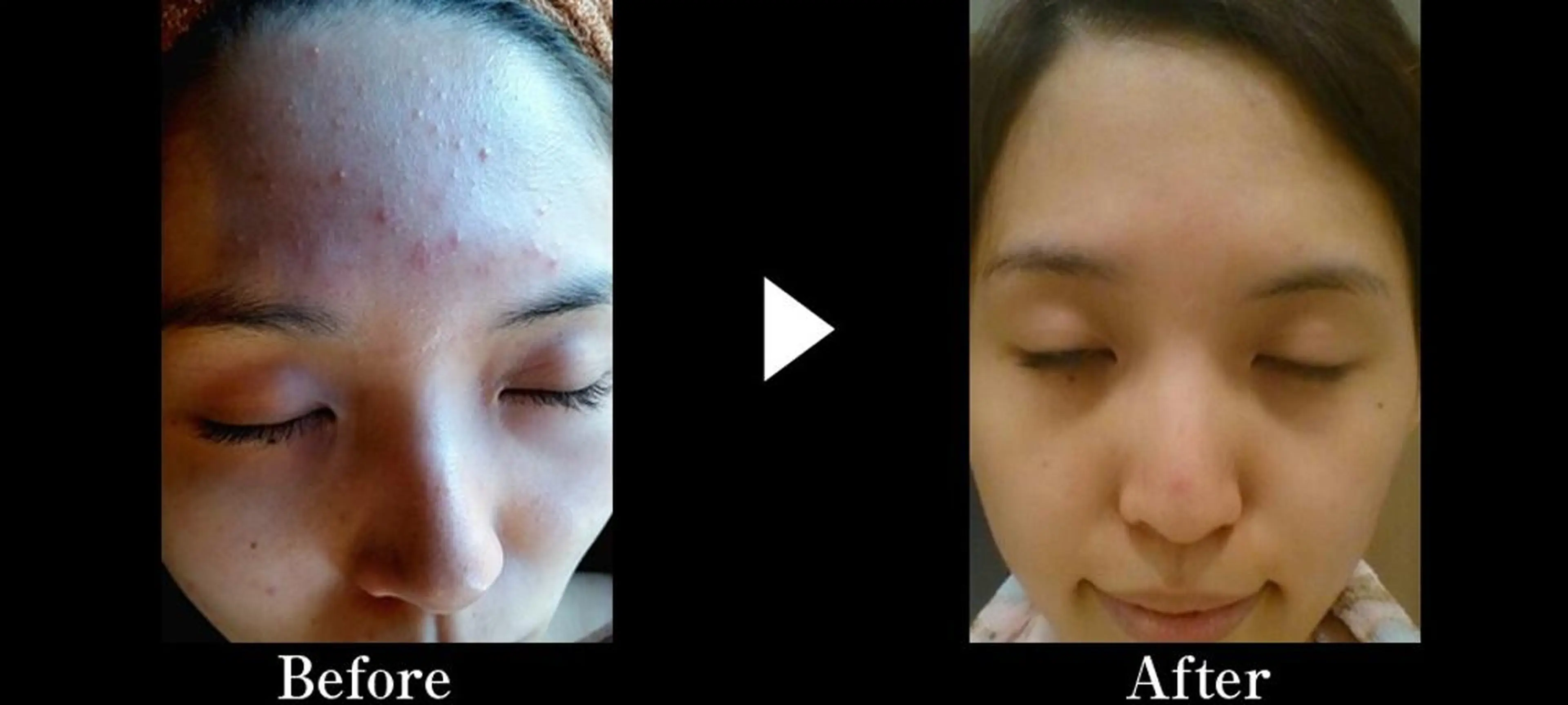 ショート ミディアム セミロング ヘアアレンジ パーマ カラー ロング メンズ キッズ ネイル マツエク・マツパ 次世代まつげパーマは 『リベル名古屋』のマツエク・マツパデザイン