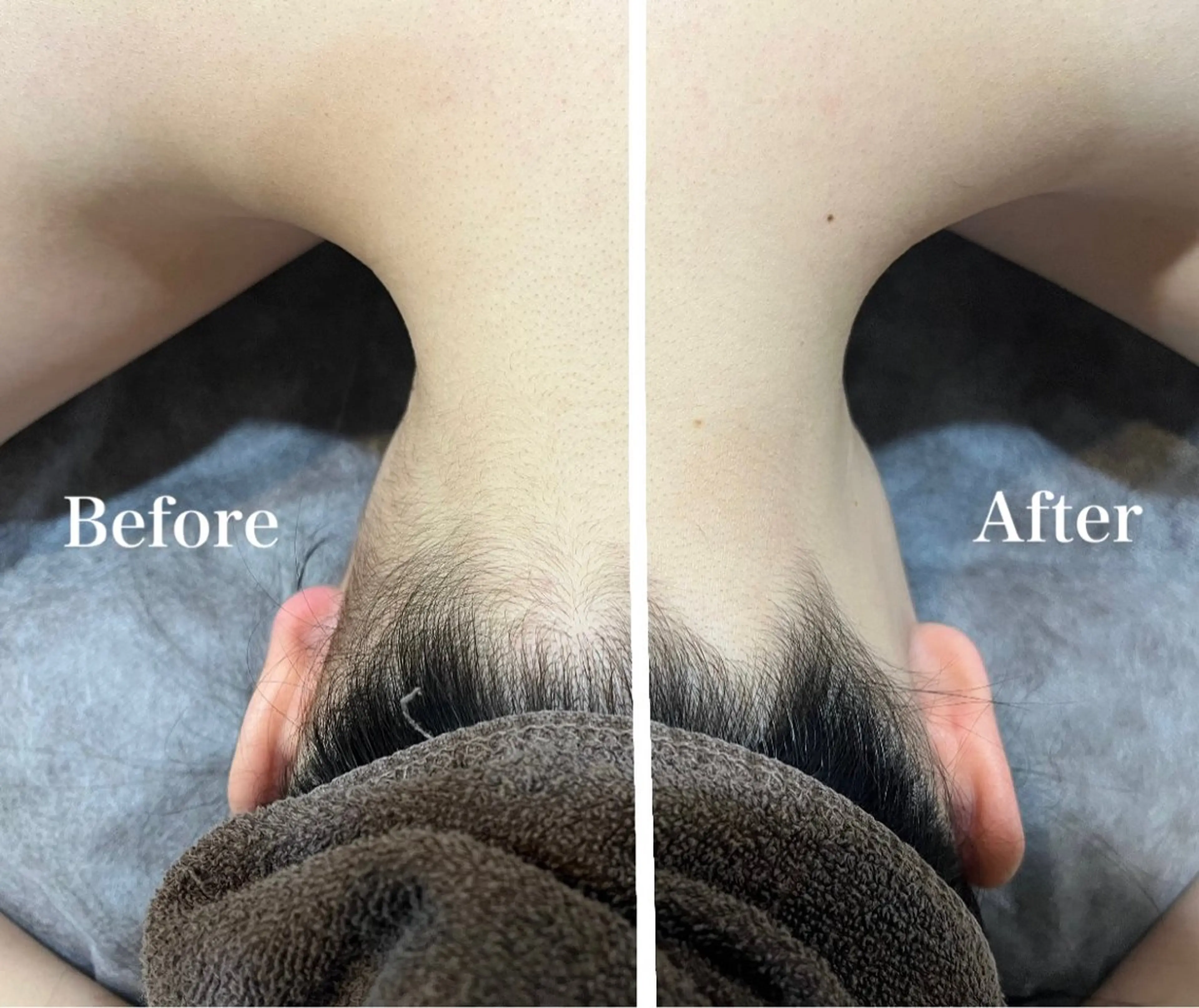 脱毛 脱毛サロン fam.豊澤柚良のエステ・リラクイメージ