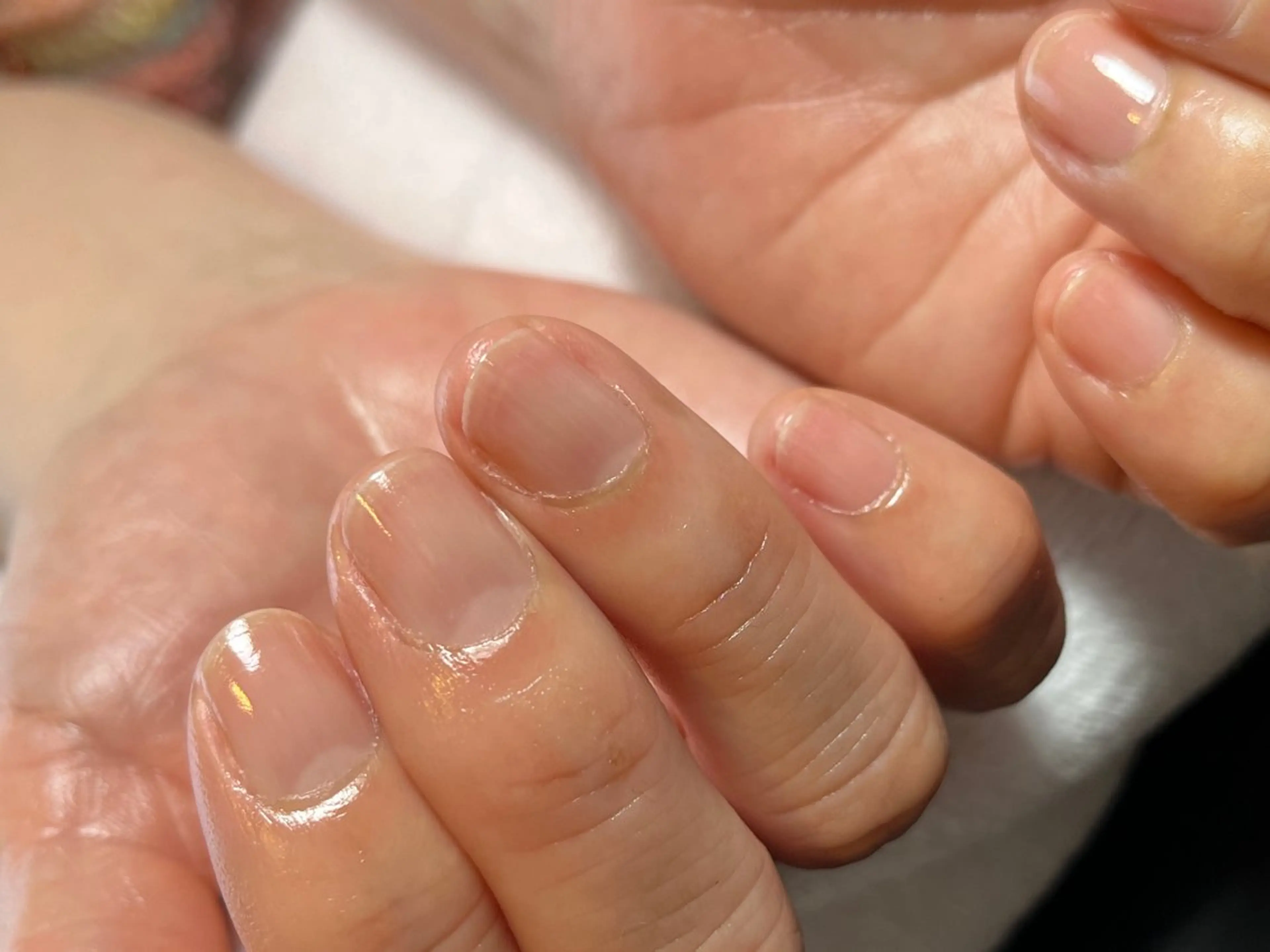 ネイル VERMA 育爪・ケア専門のネイルデザイン