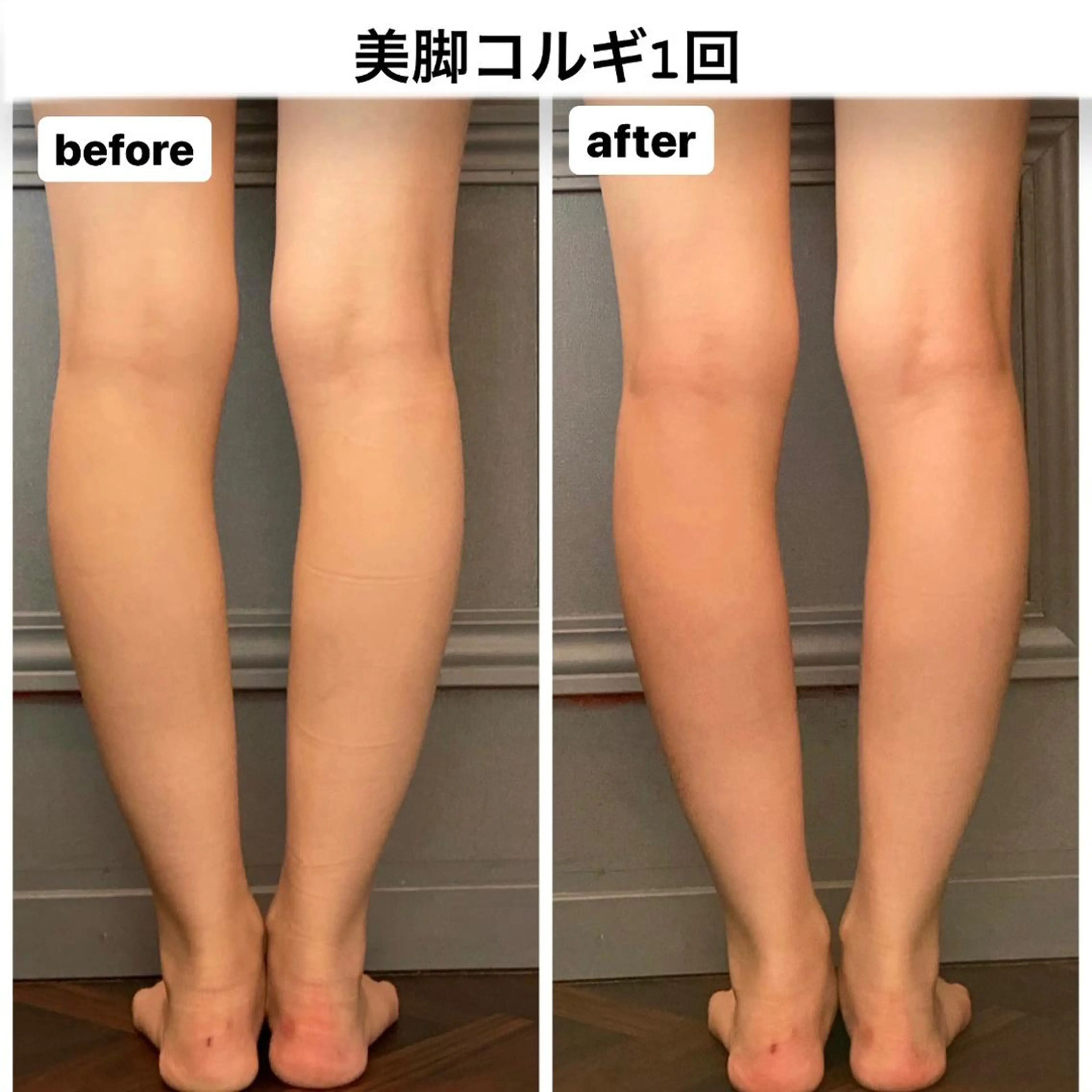 エステ リラク エステサロンino.colore'所属・小顔サロン ino.coloreのエステ・リラクイメージ