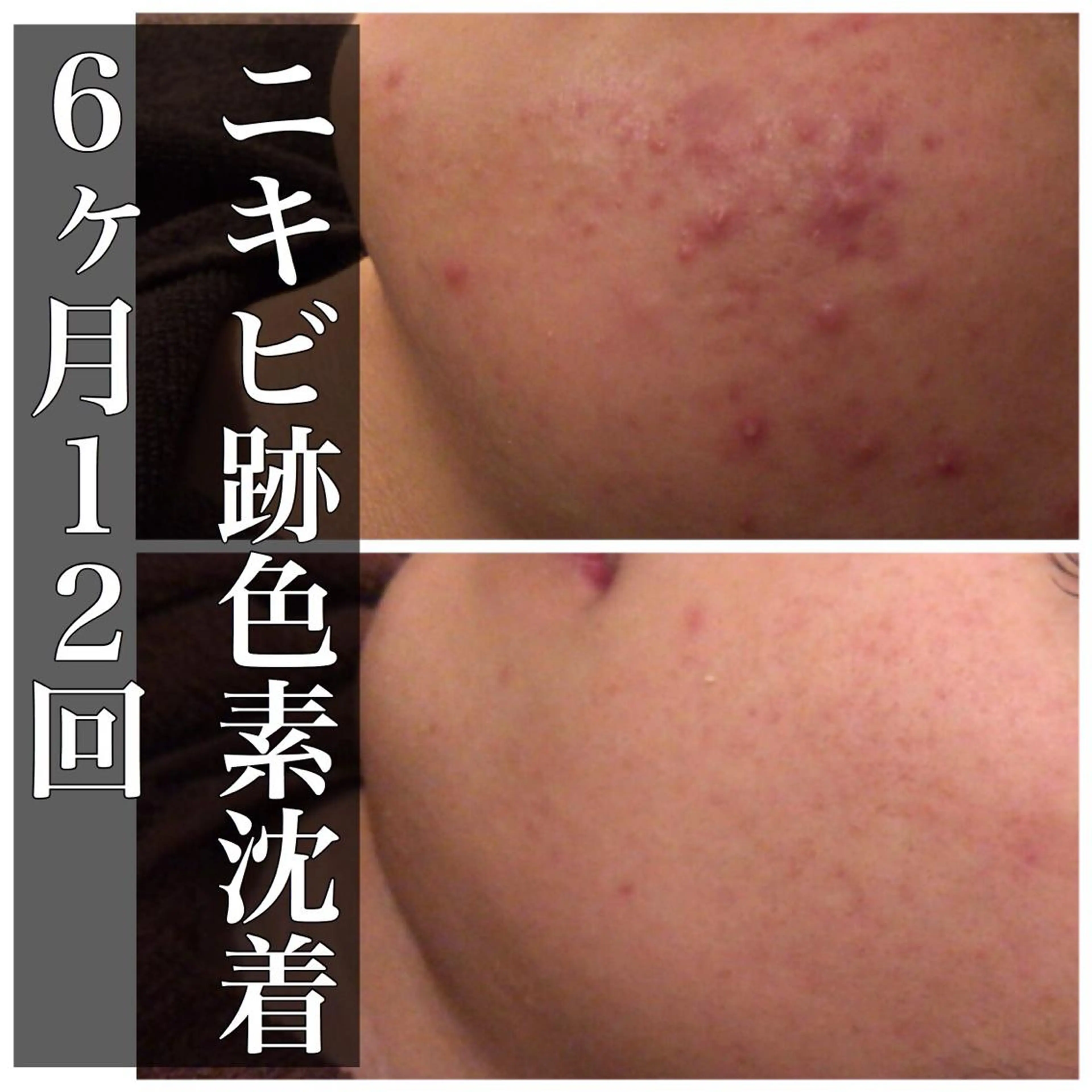 ミディアム カラー パーマ ヘアアレンジ メンズ キッズ ネイル マツエク・マツパ エステ リラク ニキビ・肌質改善専門 ♡人生が変わるサロンのエステ・リラクイメージ