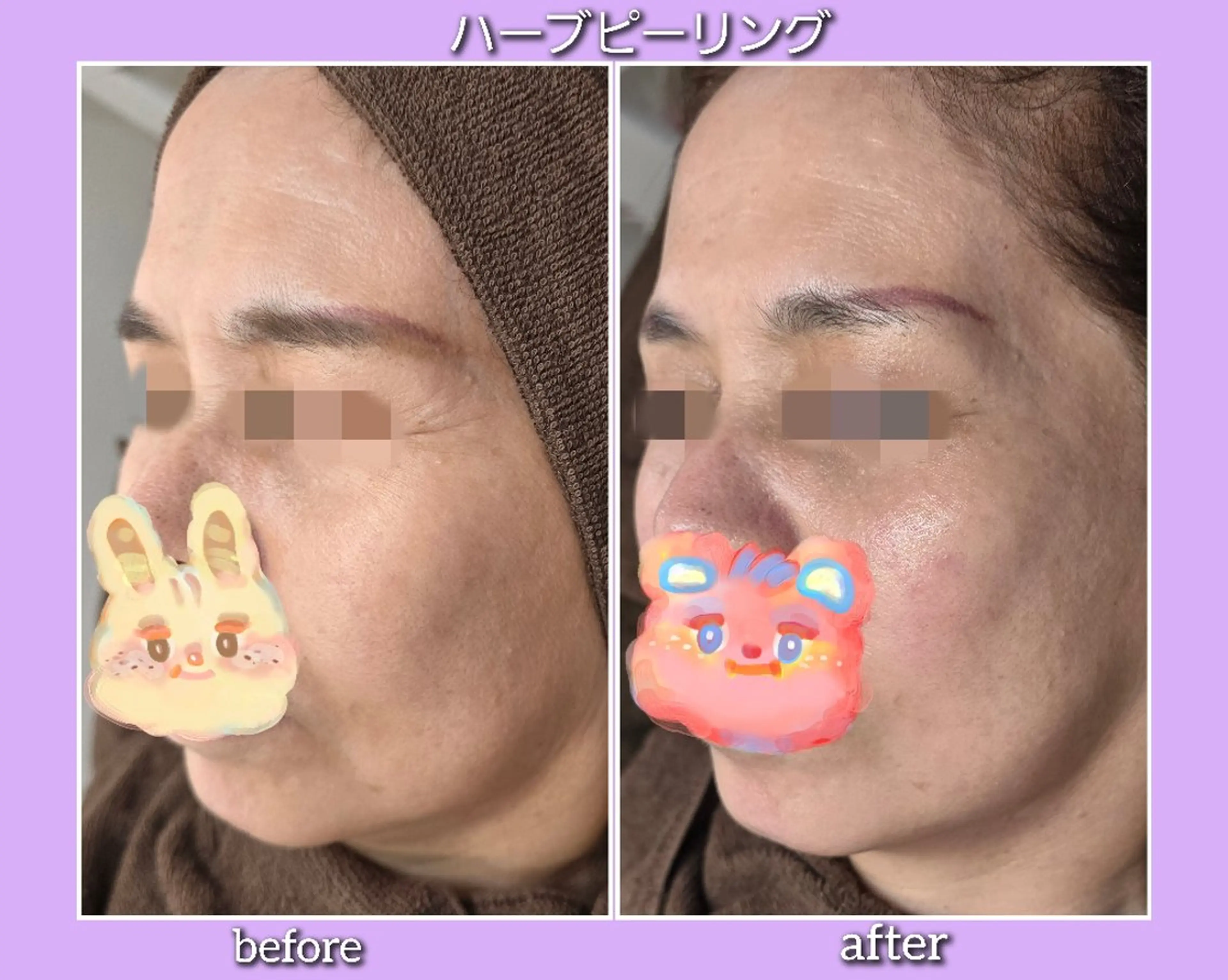 facial salon Lily所属・salon Lilyのエステ・リラクイメージ