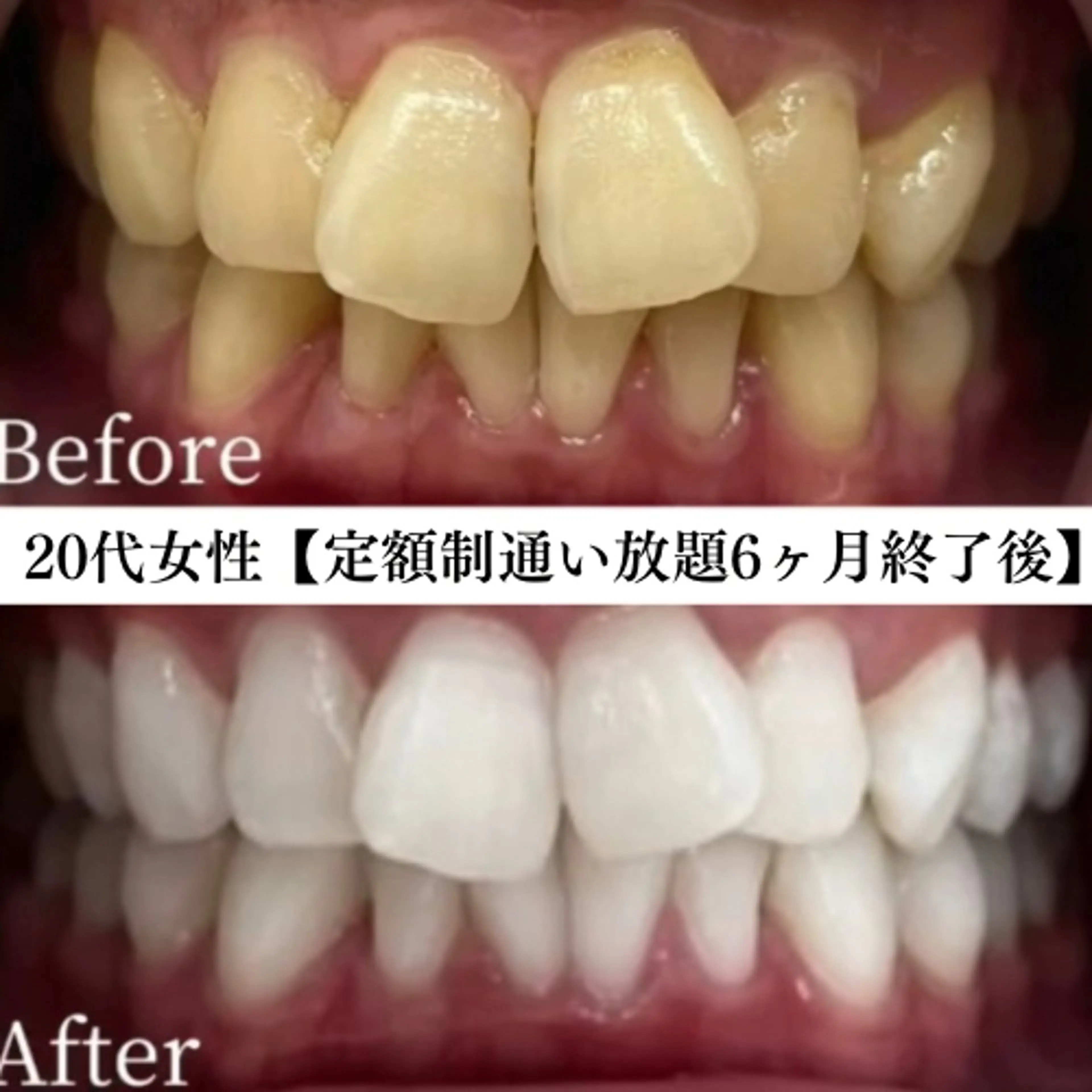 メンズ キッズ エステ リラク セルフホワイトニング専門店WHITE福岡天神店所属・セルフホワイト専門店 WHITE福岡天神店のエステ・リラクイメージ