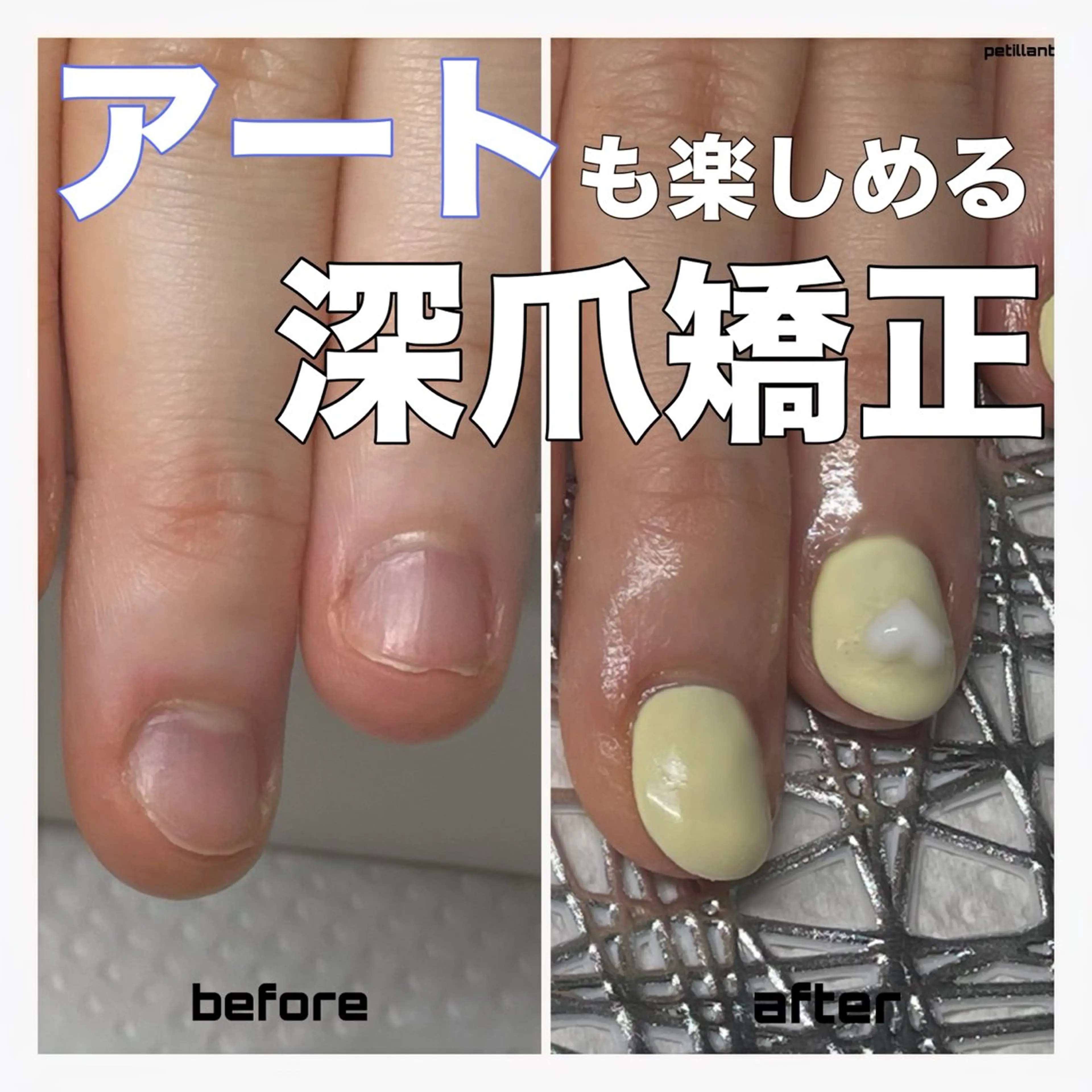ネイル アートネイル クリアネイル petillant所属・nail salon petillantのネイルデザイン