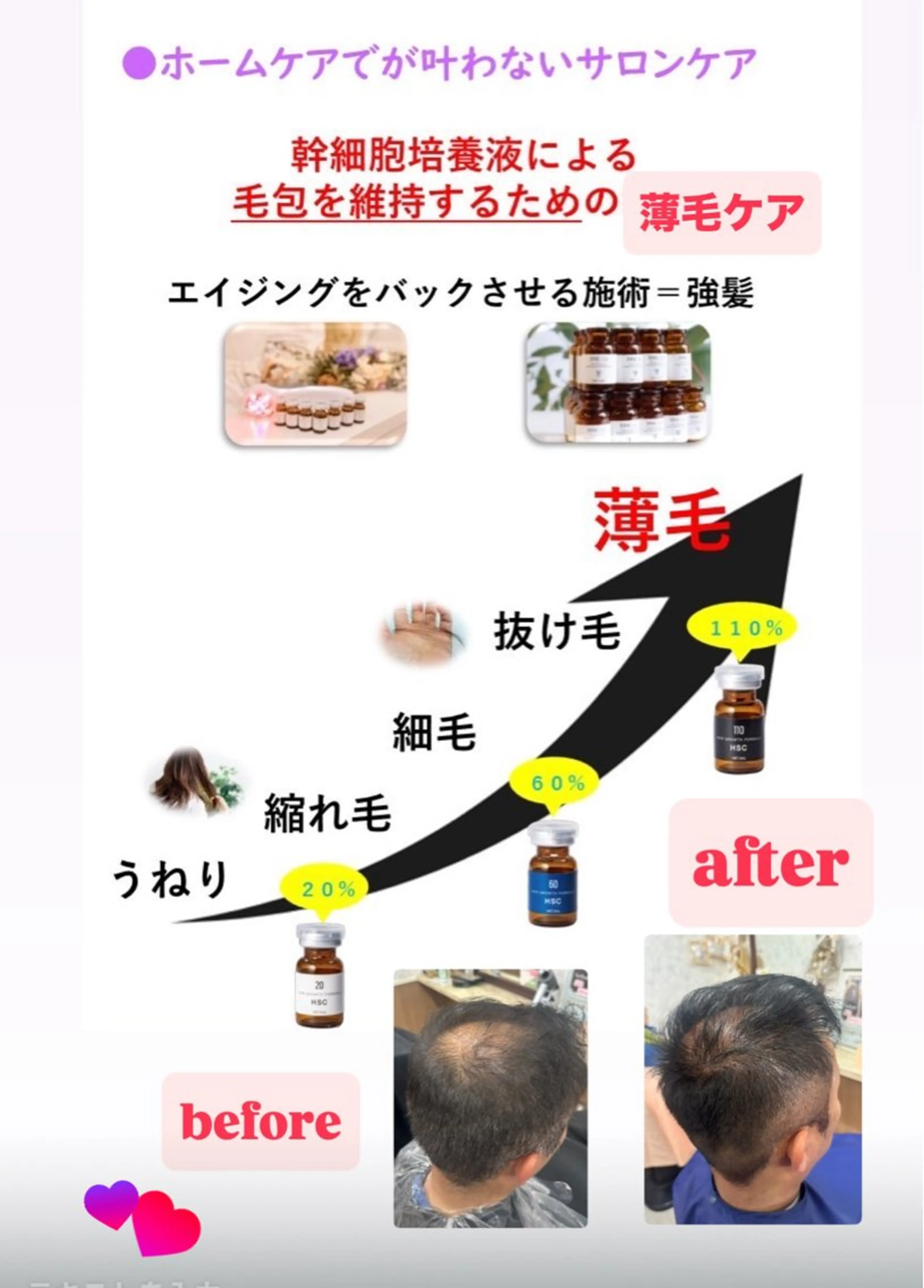 強髪メニュー(髪を増やしていく1回目価格)濃度20%の写真