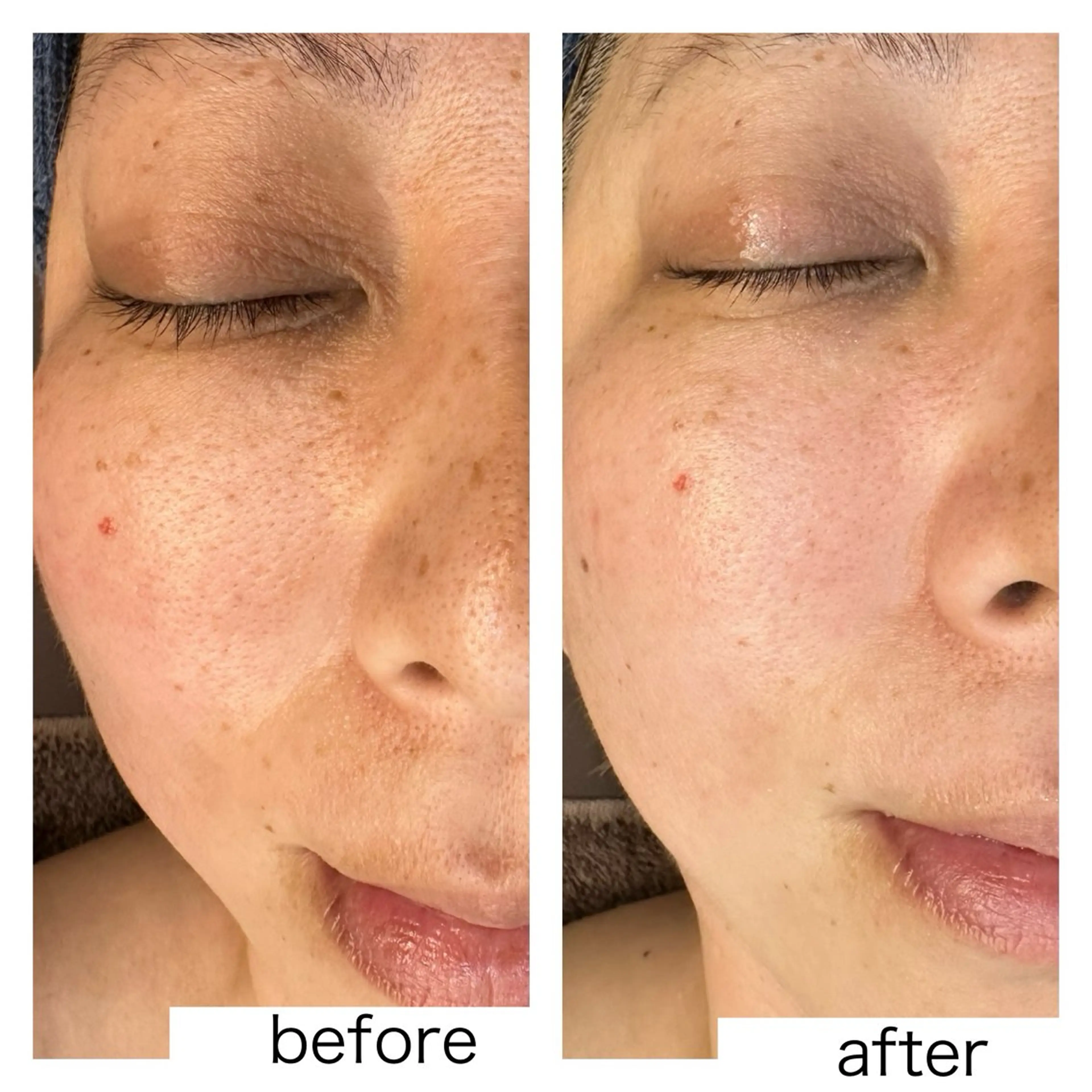 leolo武蔵浦和 肌質改善＆脱毛のエステ・リラクイメージ