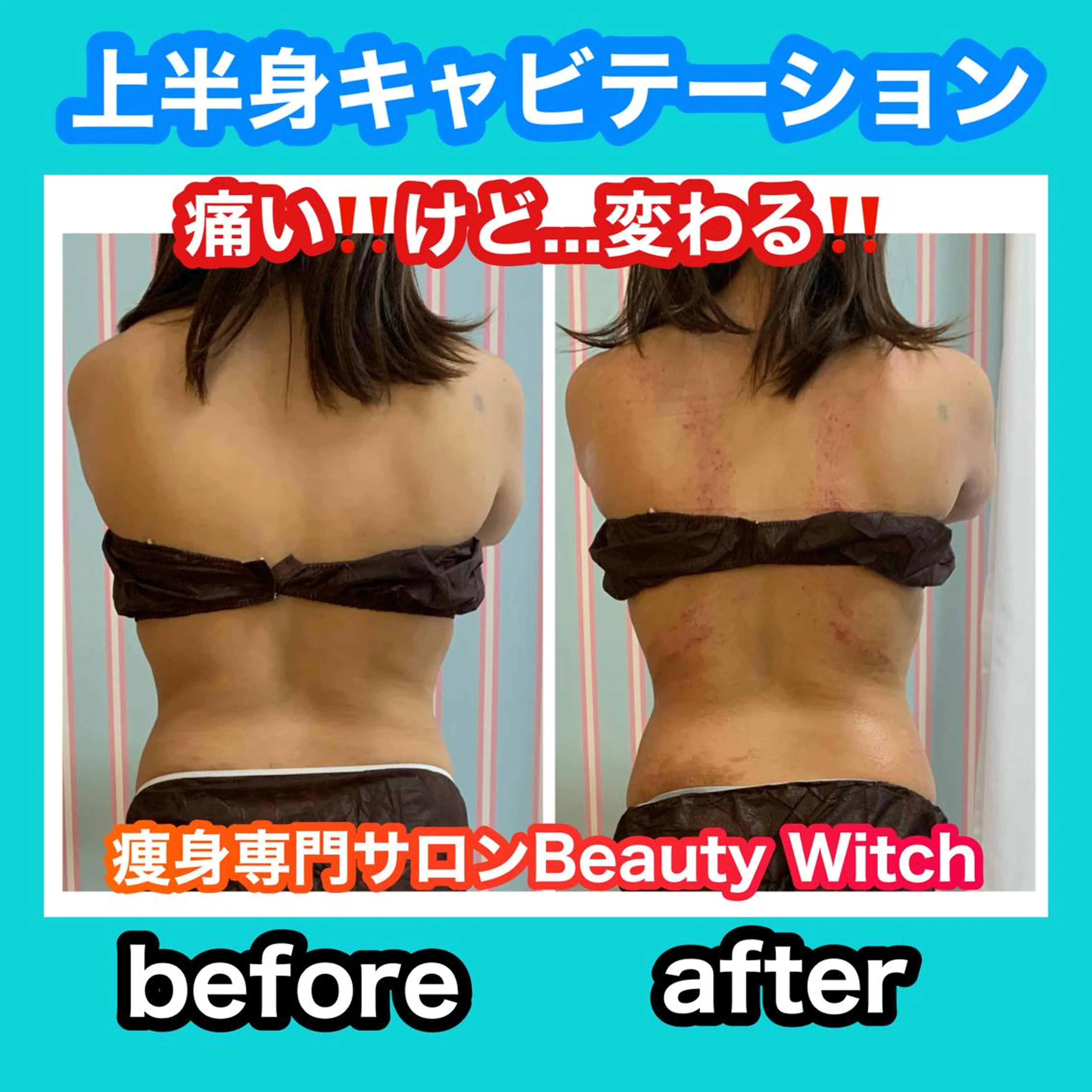 エステ リラク 痩身/脱毛/ネイル HARUKAのエステ・リラクイメージ