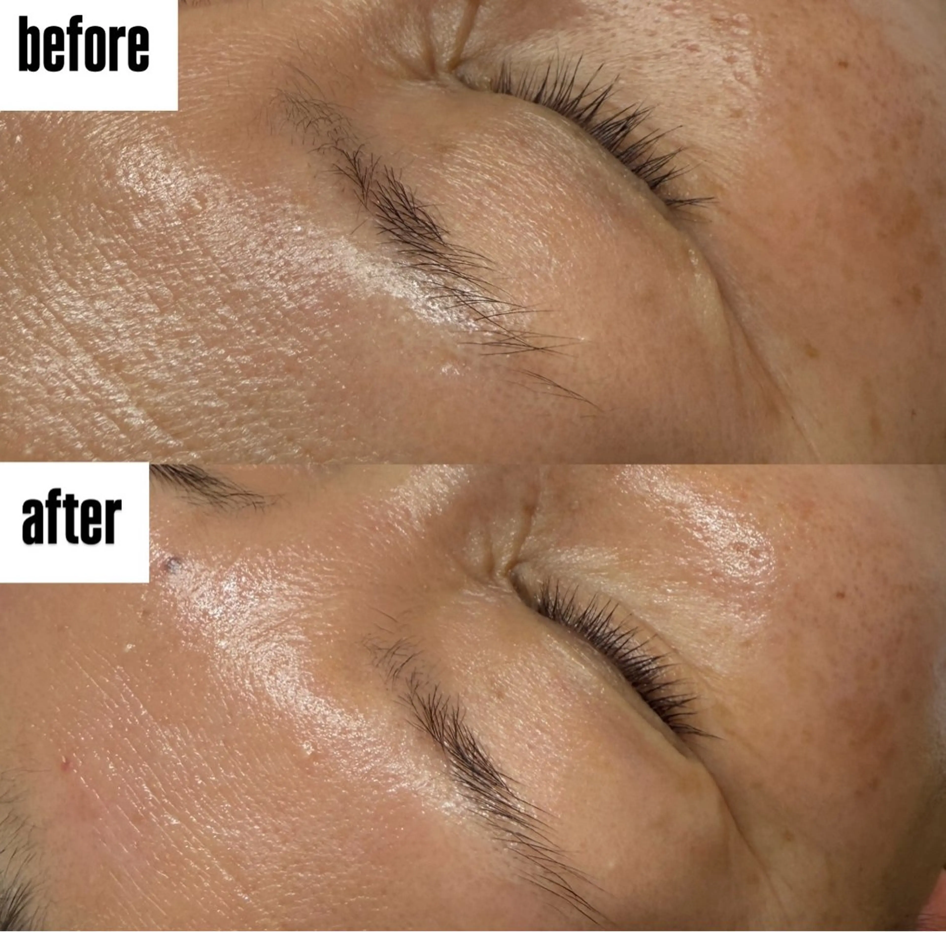 フェイシャルワックス✨️✨️(お肌ツルツル)の写真