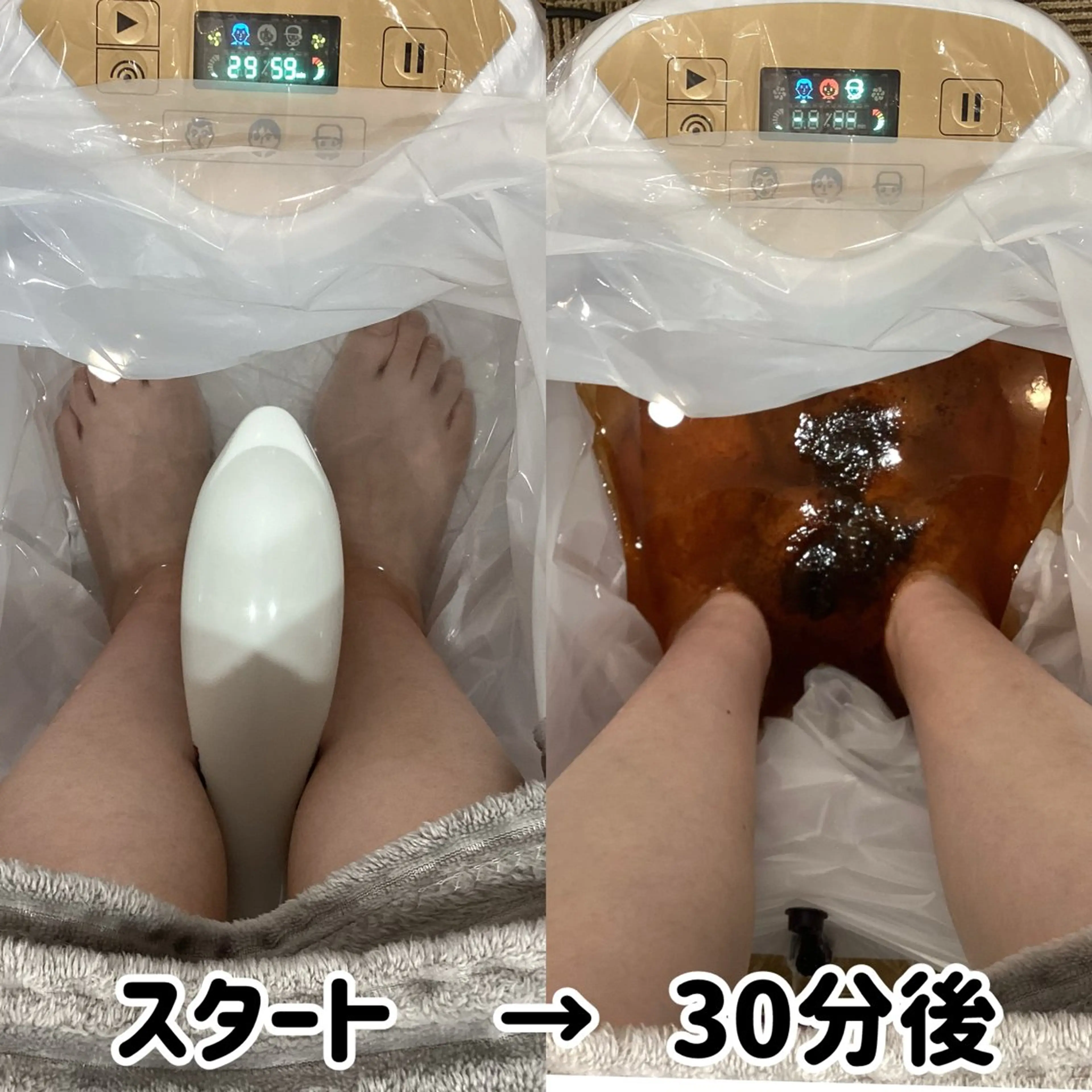 頭皮アンチエイジング L+ 秋葉原上野のエステ・リラクイメージ