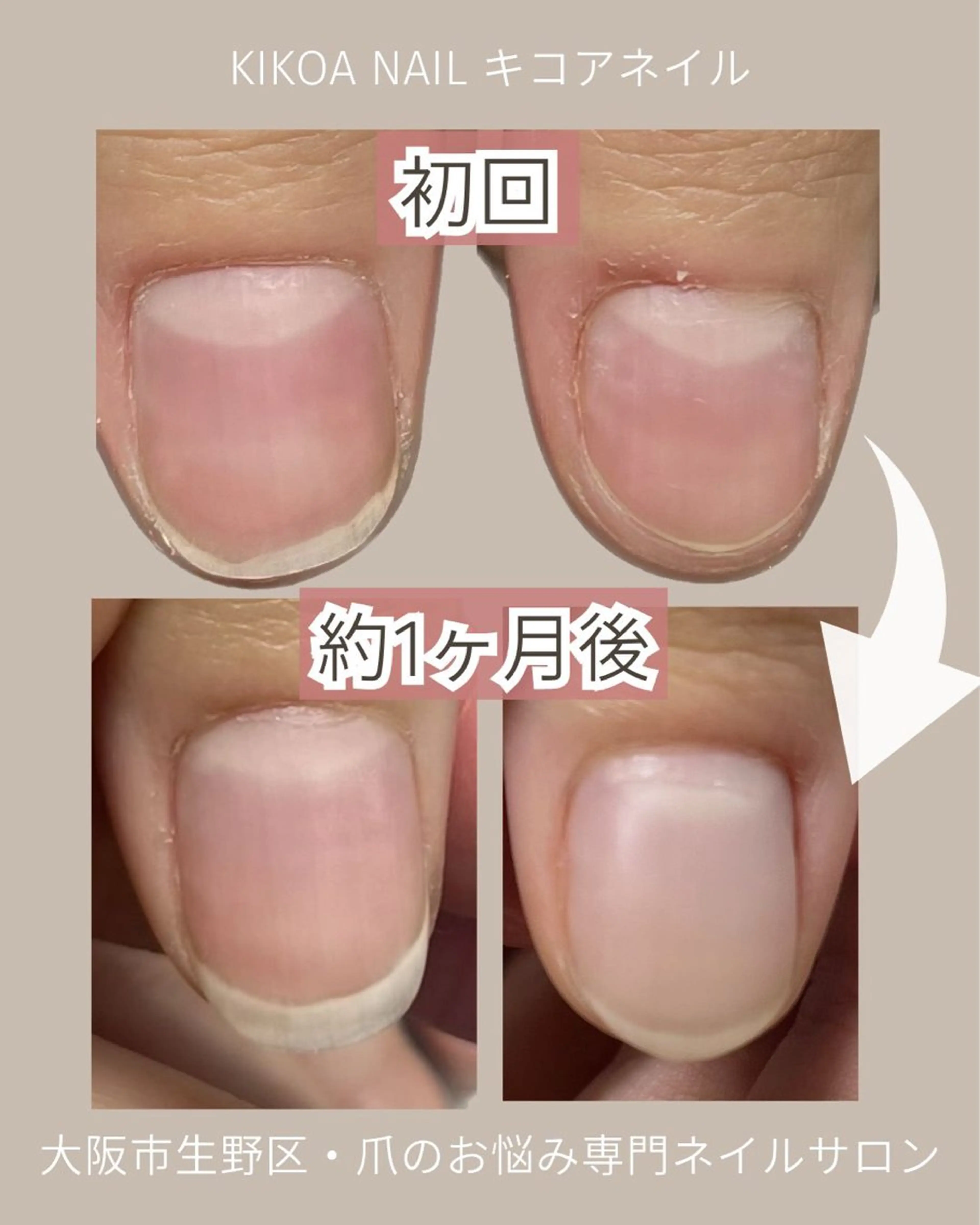 ネイル KIKOA NAIL キコアネイルのネイルデザイン