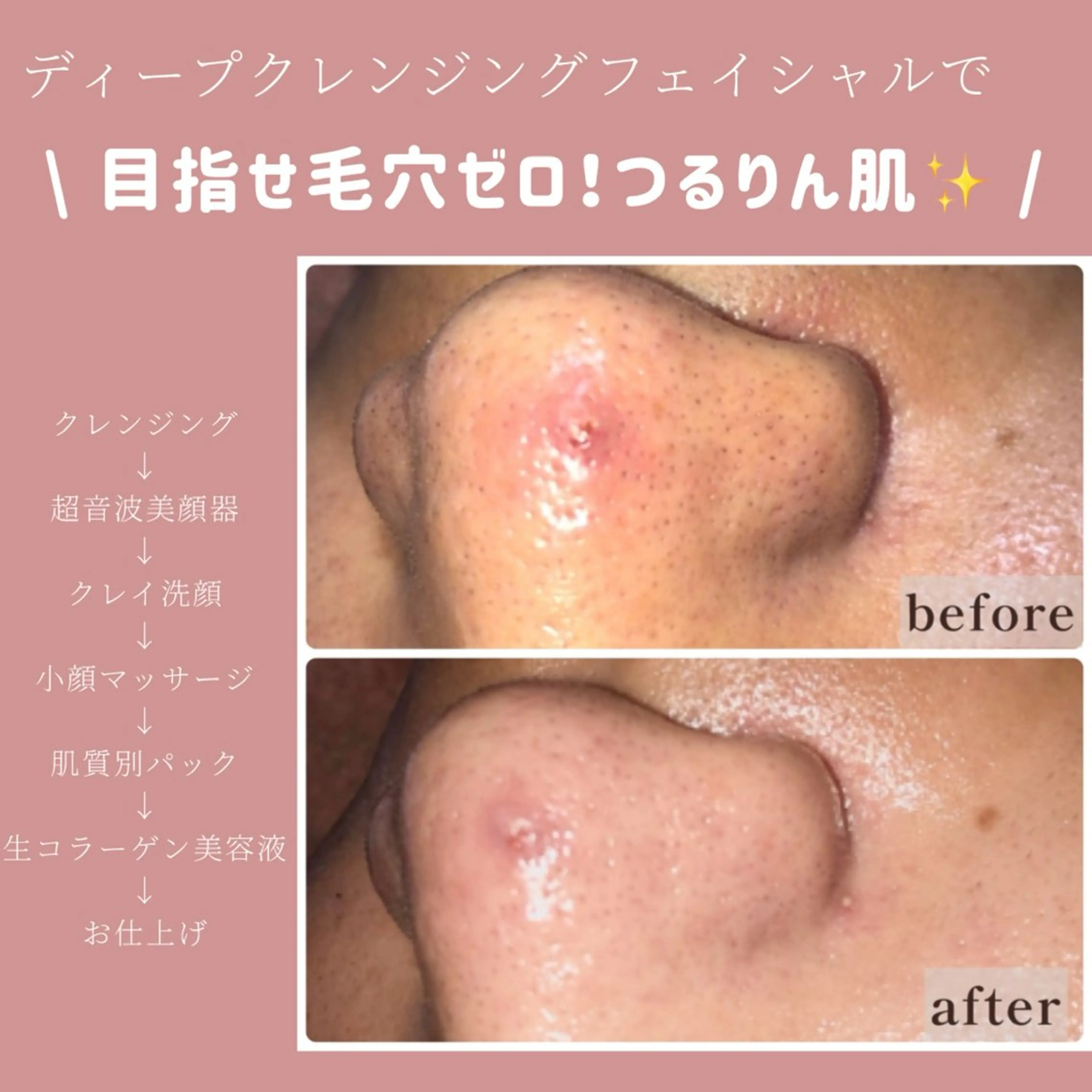 エステ VANCOUNCIL 中村有希のエステ・リラクイメージ