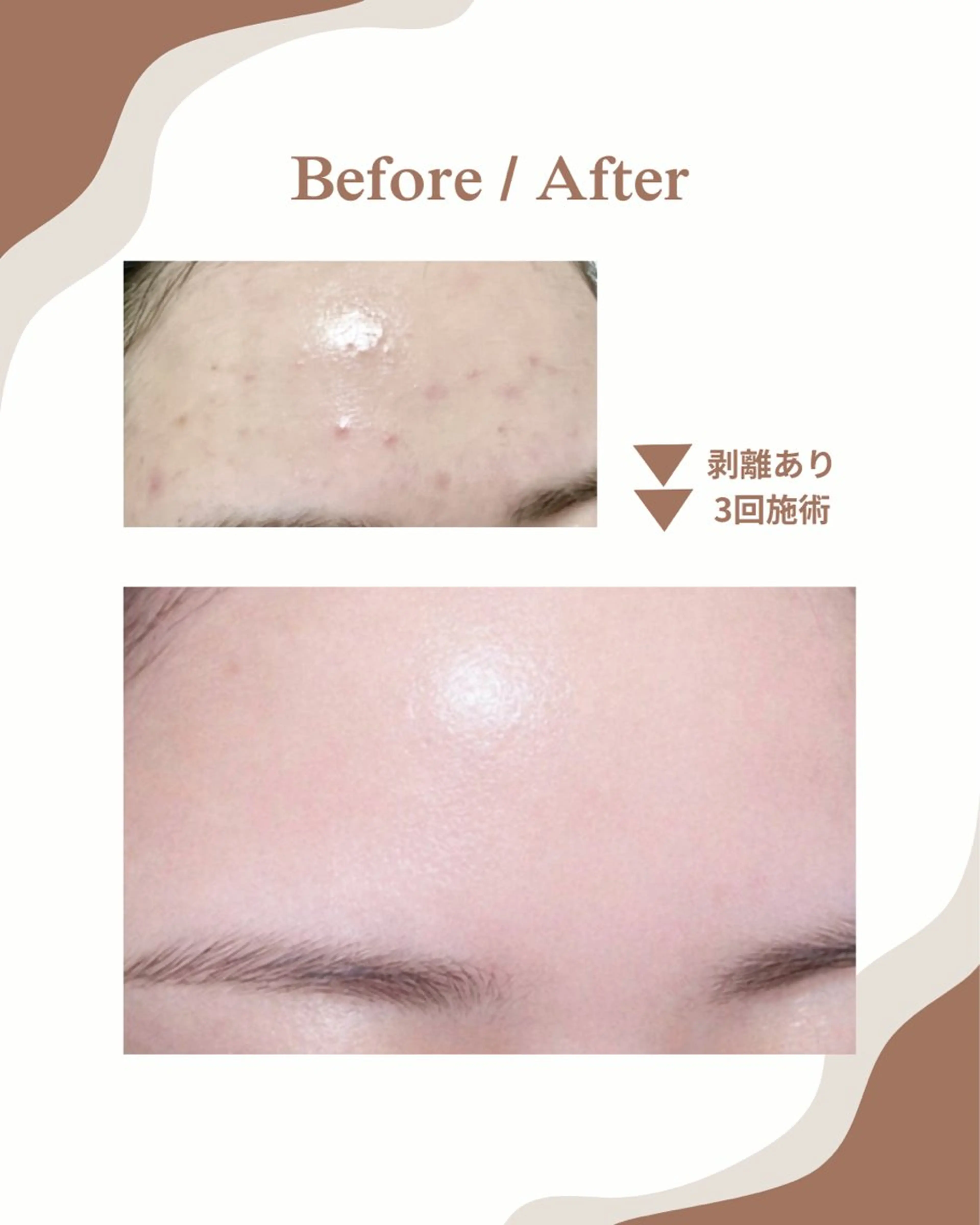 エステ myherb所属・ニキビ肌改善サロン myherb🌿のエステ・リラクイメージ