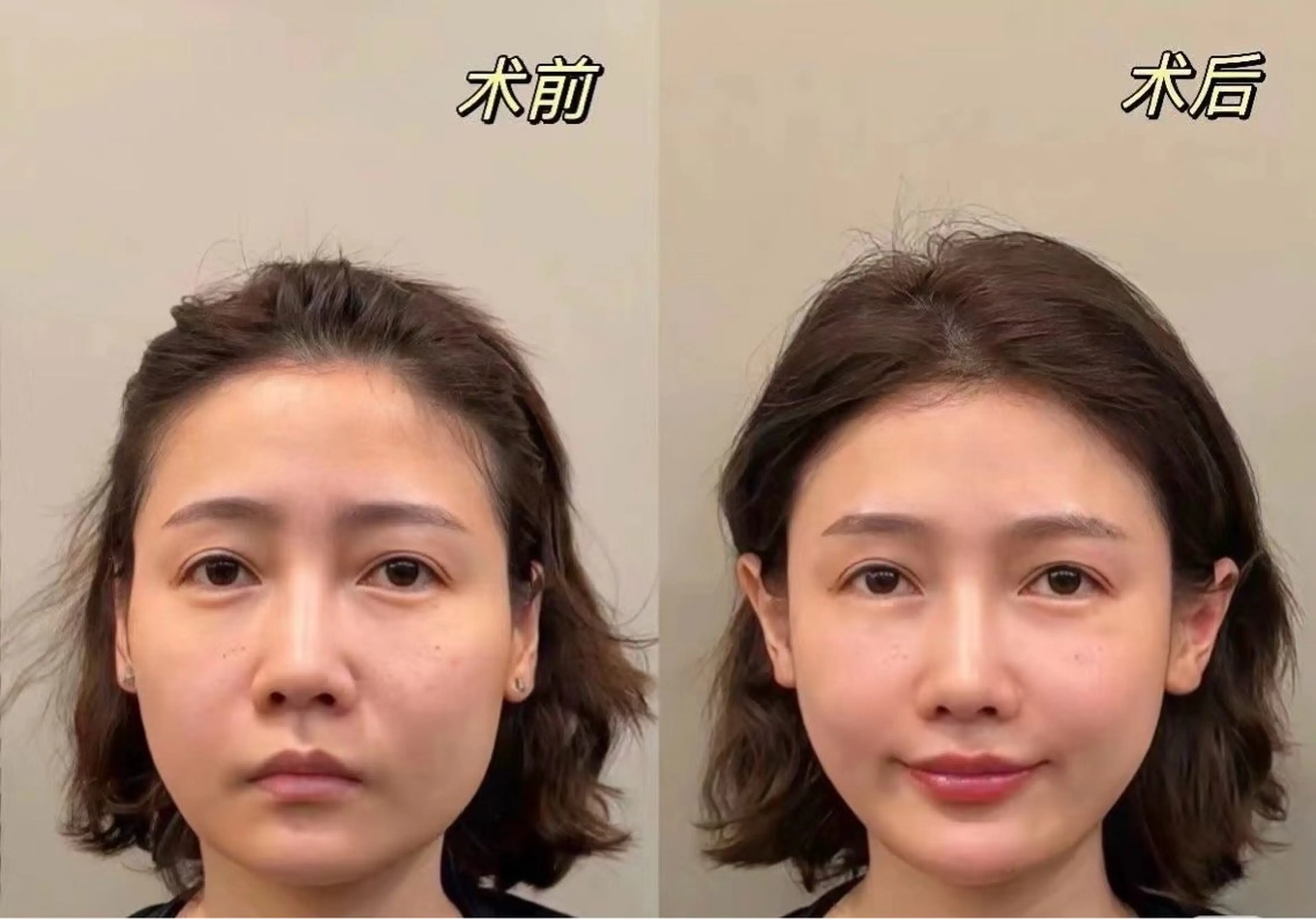 アイブロウ エステ リラク 愛維美水光美肌専門店所属・愛維美水光美肌専門店 メンズレディースokのエステ・リラクイメージ