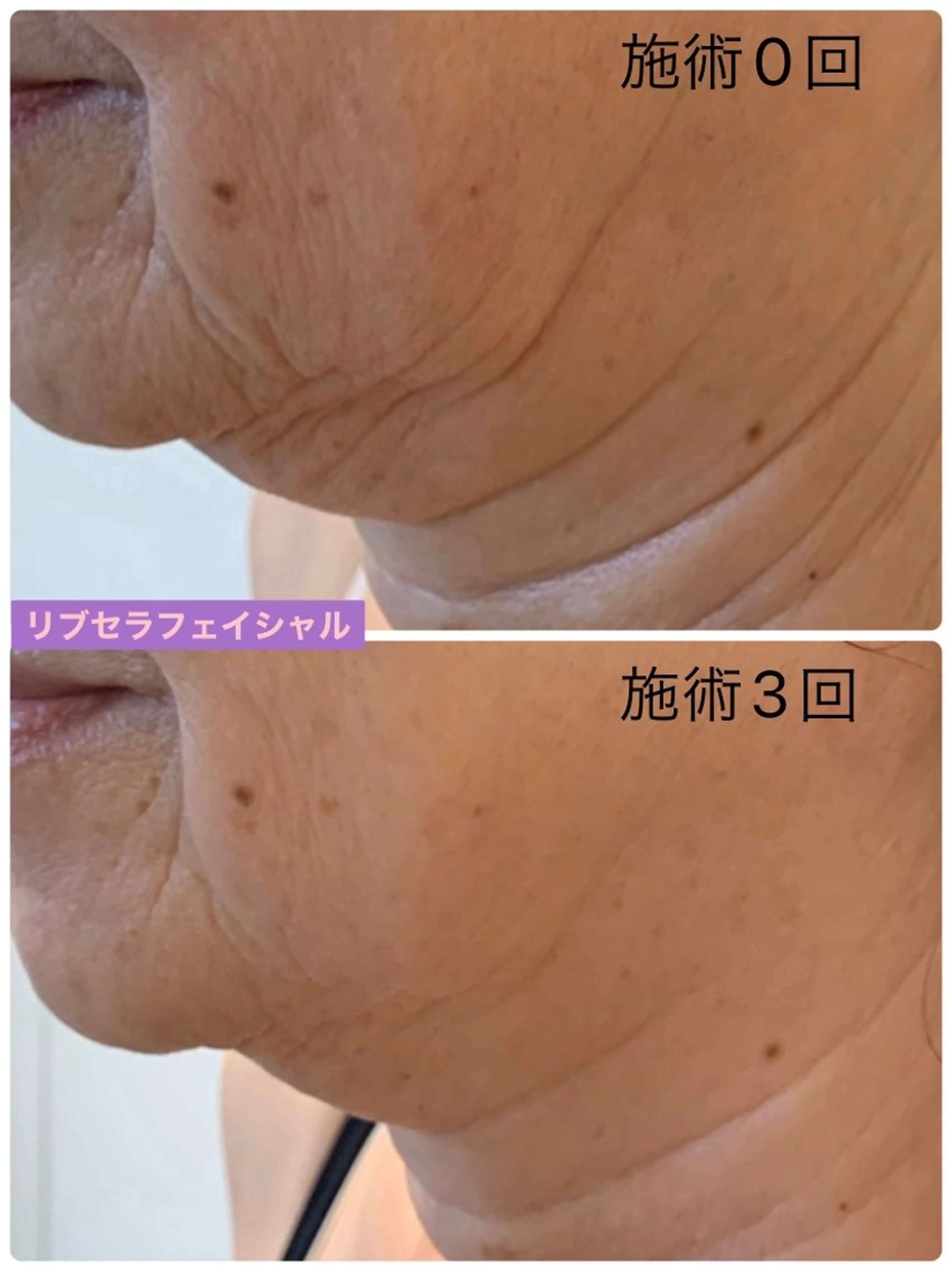 エステ Private Salon Prunelle所属・プライベートサロン プリュネルのエステ・リラクイメージ